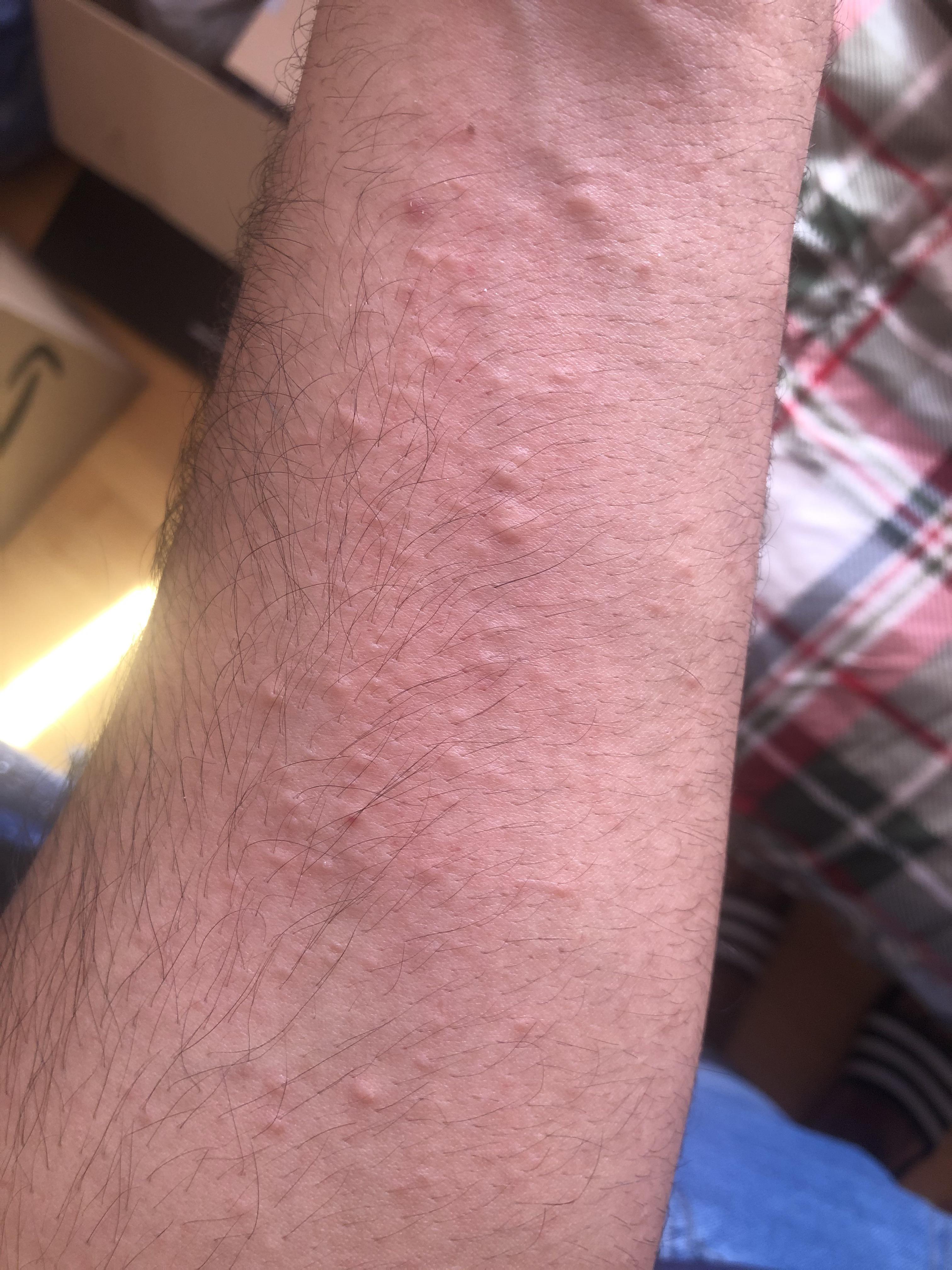 After treatment scratching, this happened after scratching, I have