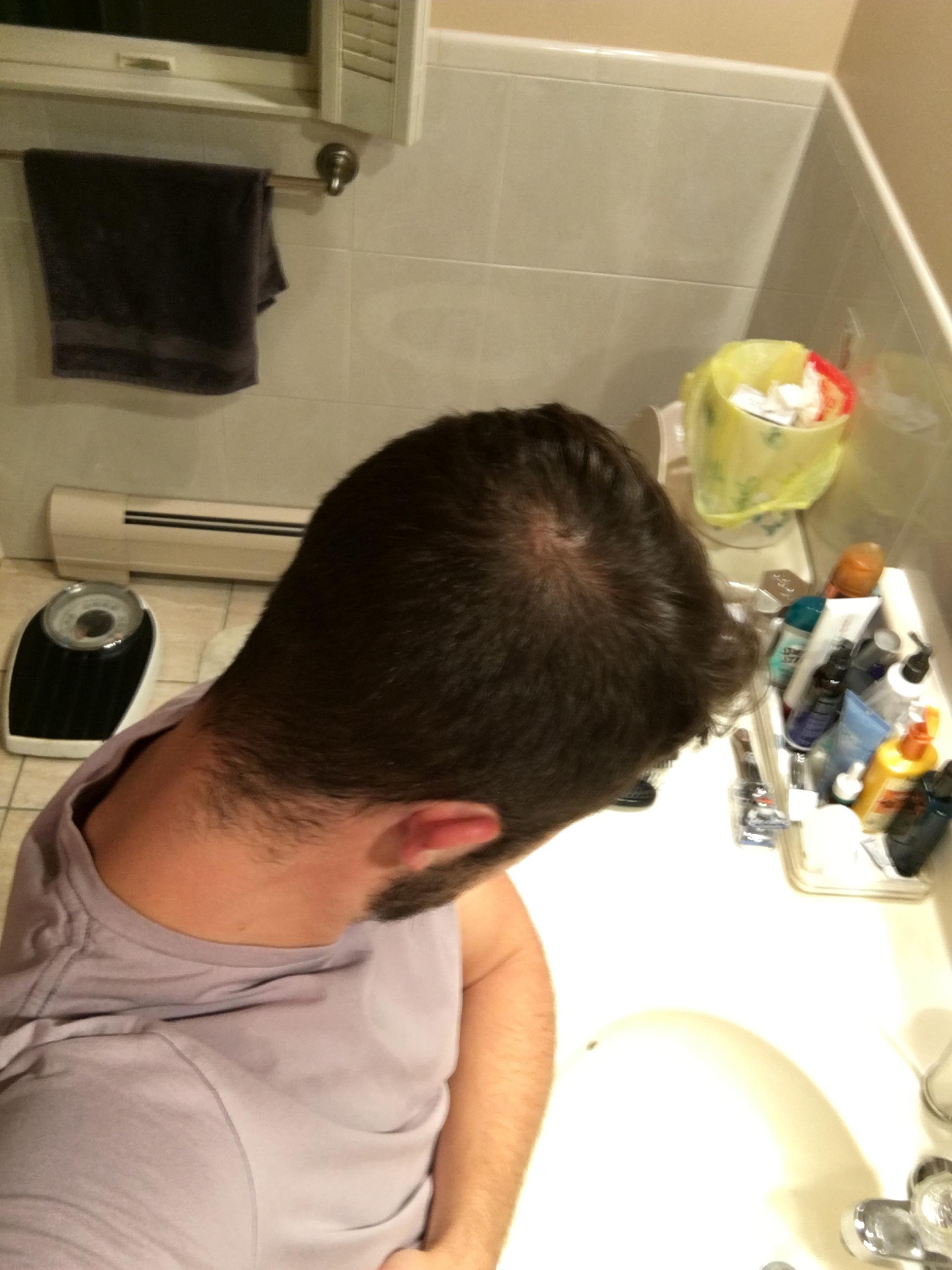 cowlick or baldspot in the back? Starting to fear that I’m going bald