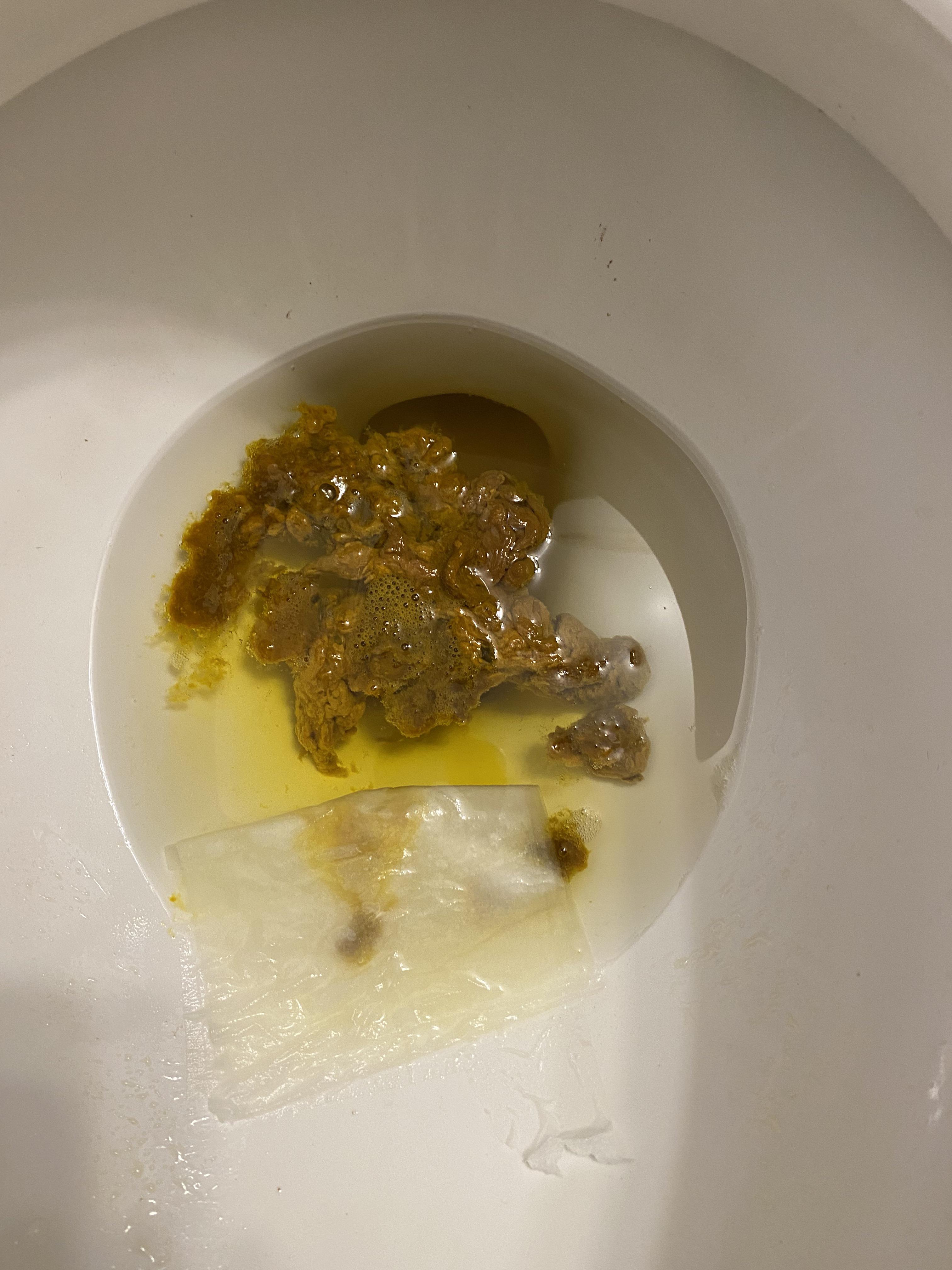 Experiencing a lot of digestive issues, this is after taking Metamucil