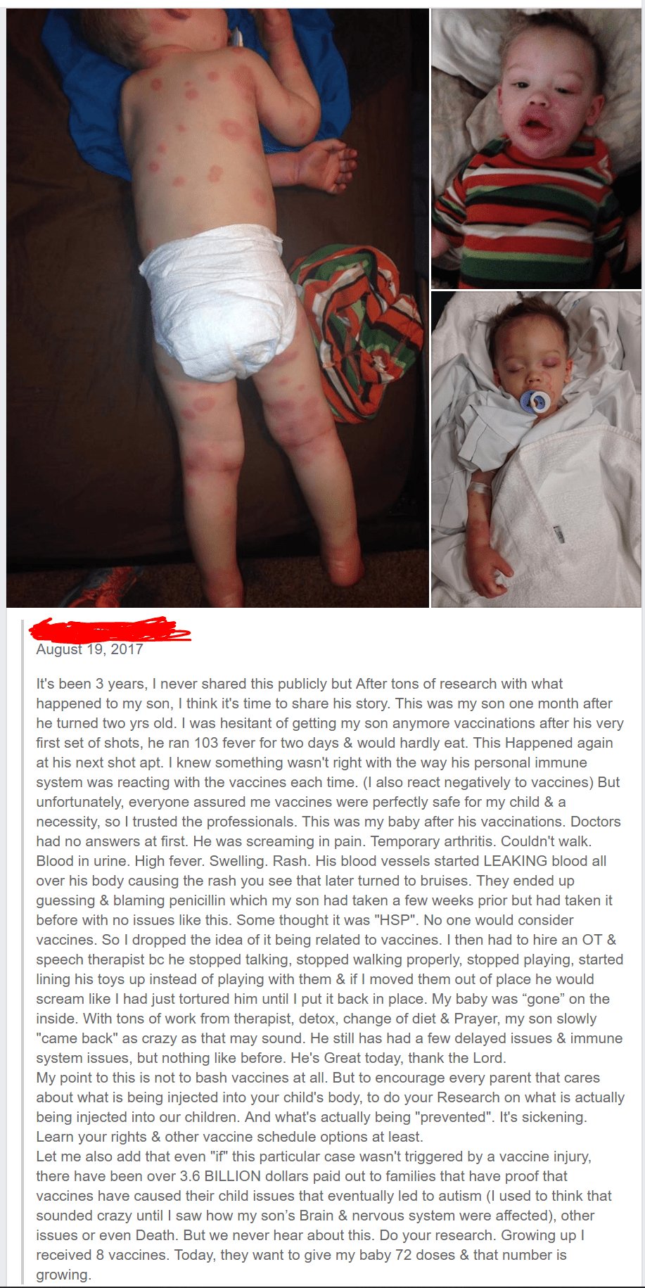 Right a vaccine caused this... and doctors have no idea