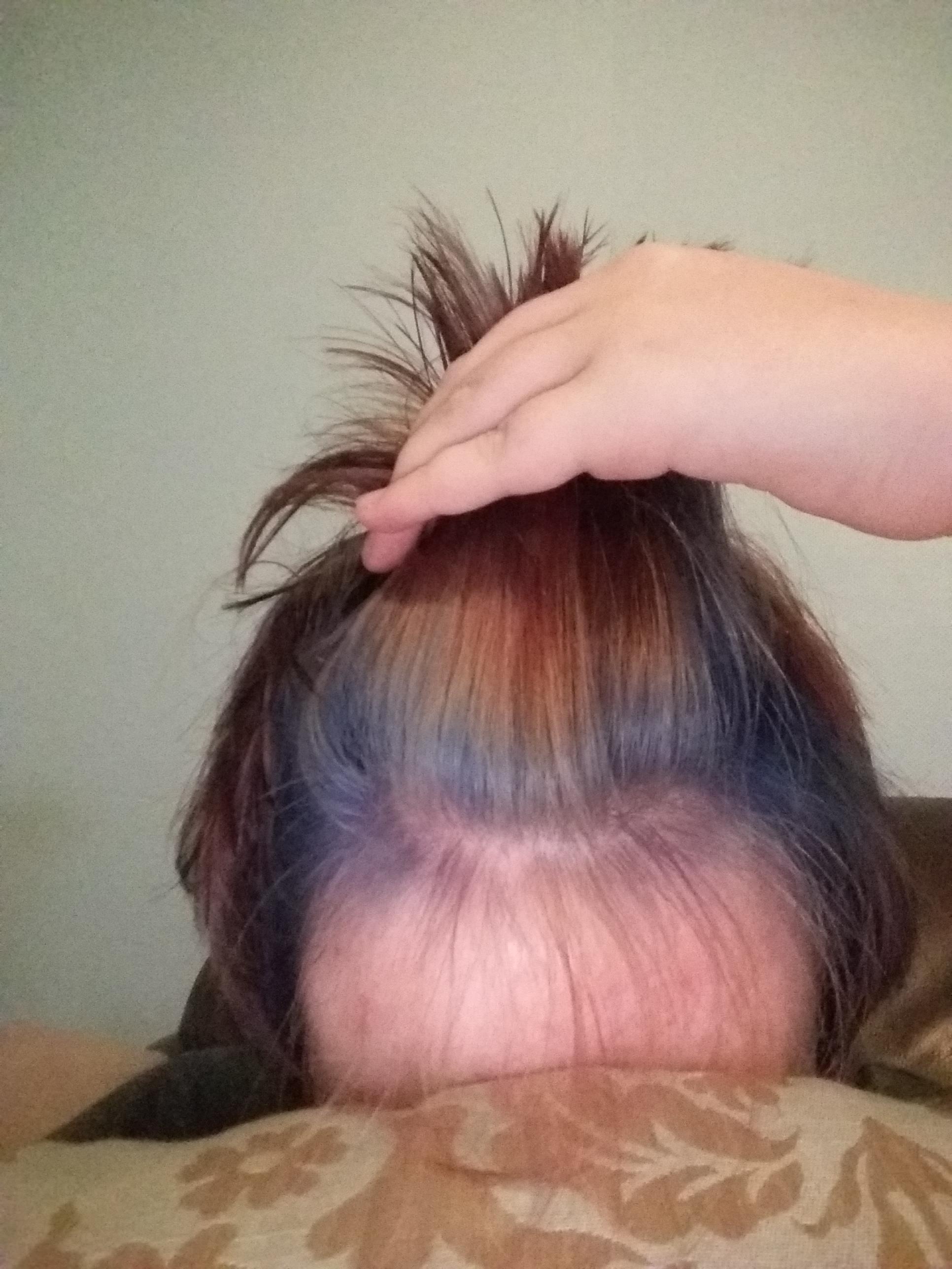 Tried bleaching my hair to get rid of the red so I could go deep blue
