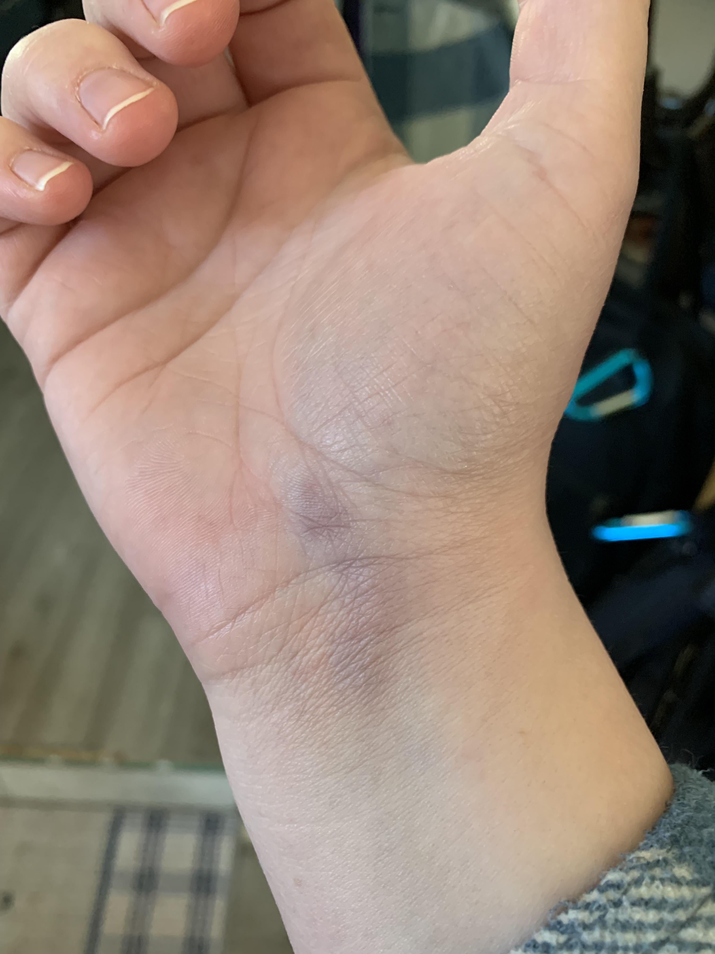 Wrist hurtsdo I need better wrist guards? It’s always my right wrist