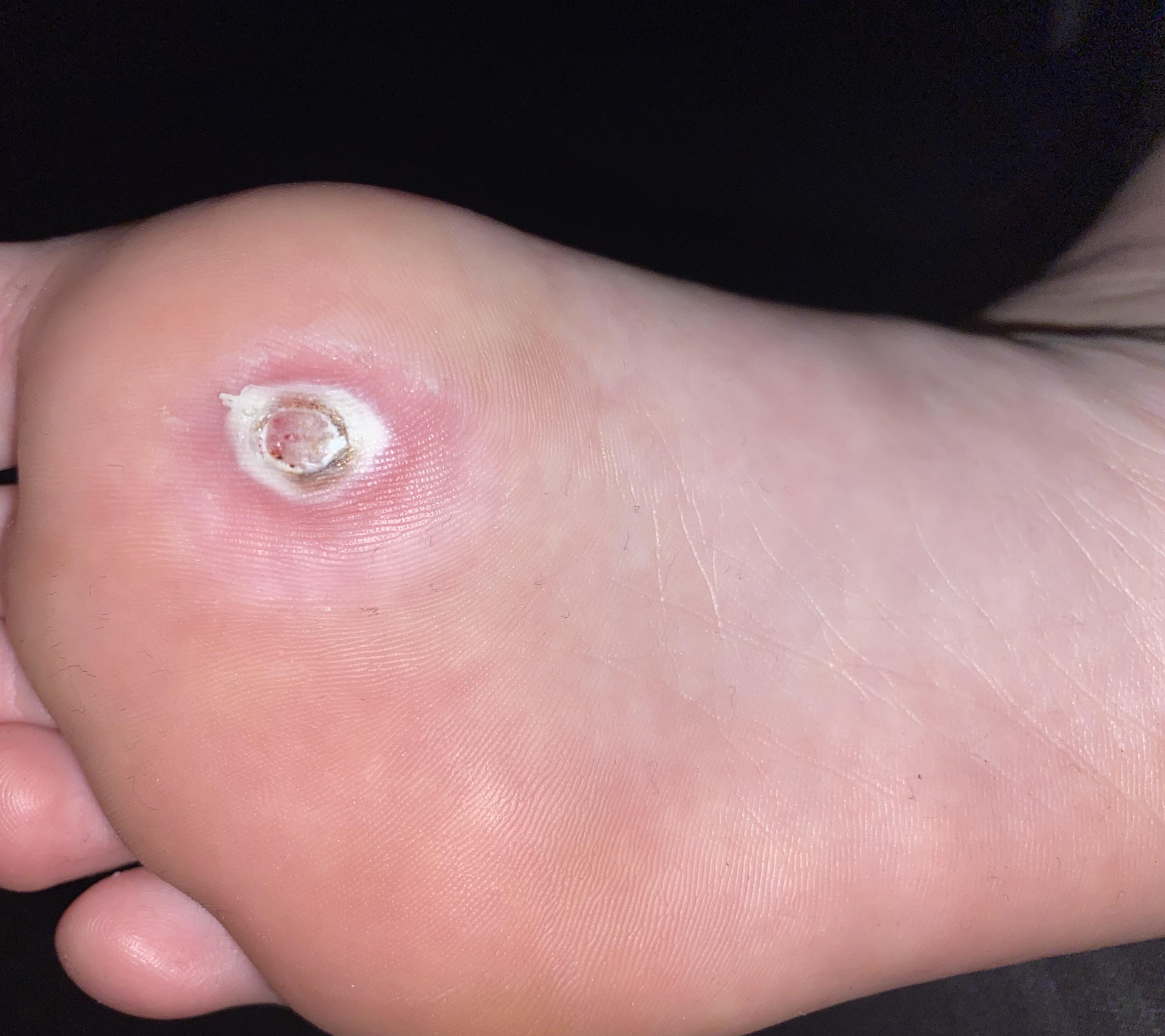 week after diff OTC methods. does this look normal? going in for beetle