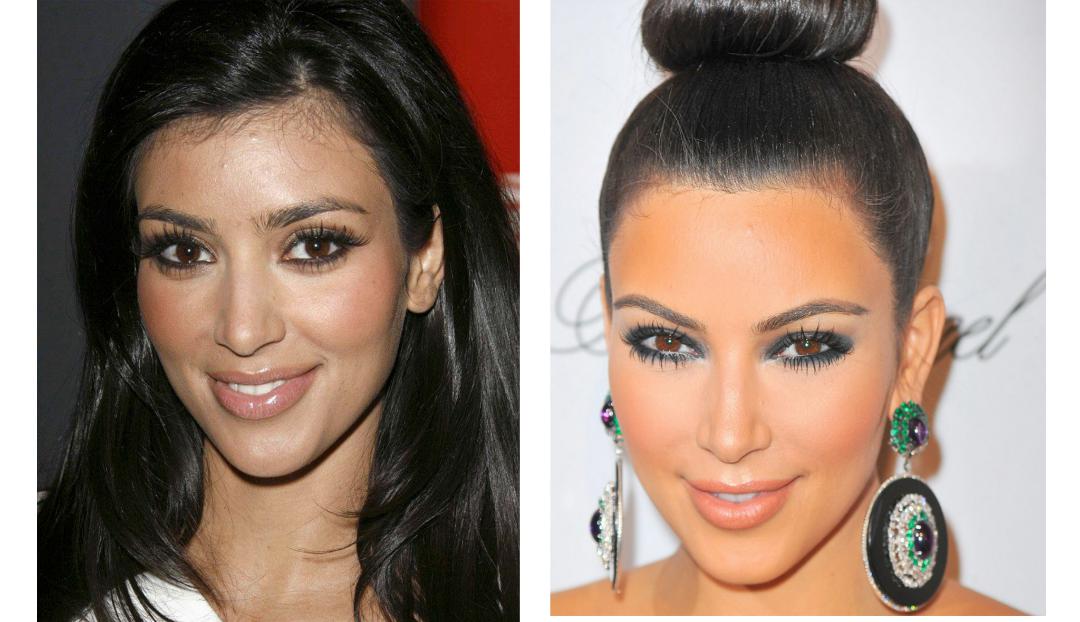 Kim before and after lazering her baby hairs. KUWTK