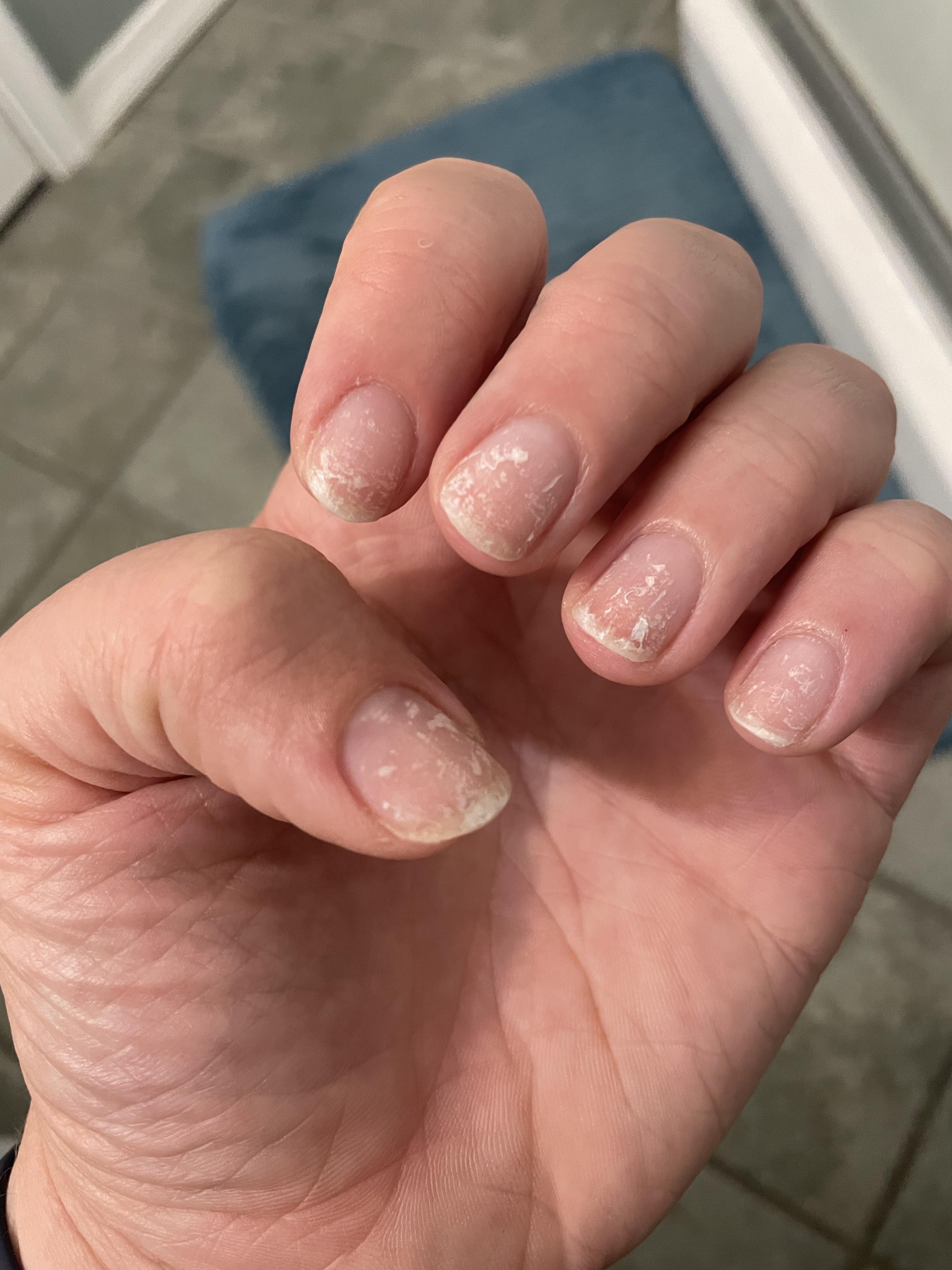 Gel Polish Peels Off