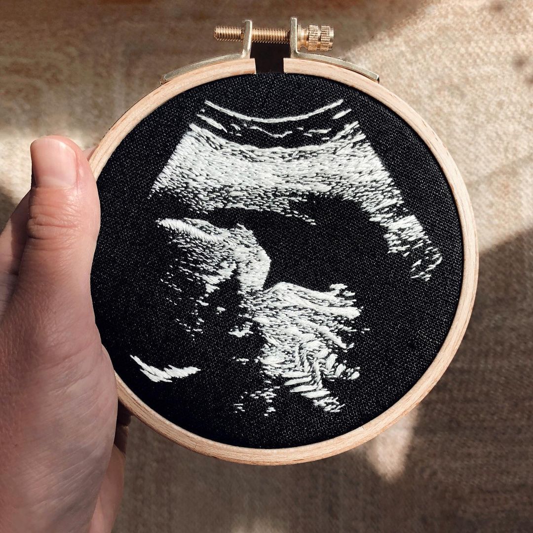 Baby Ultrasound by Veselka Bulkan r/Embroidery