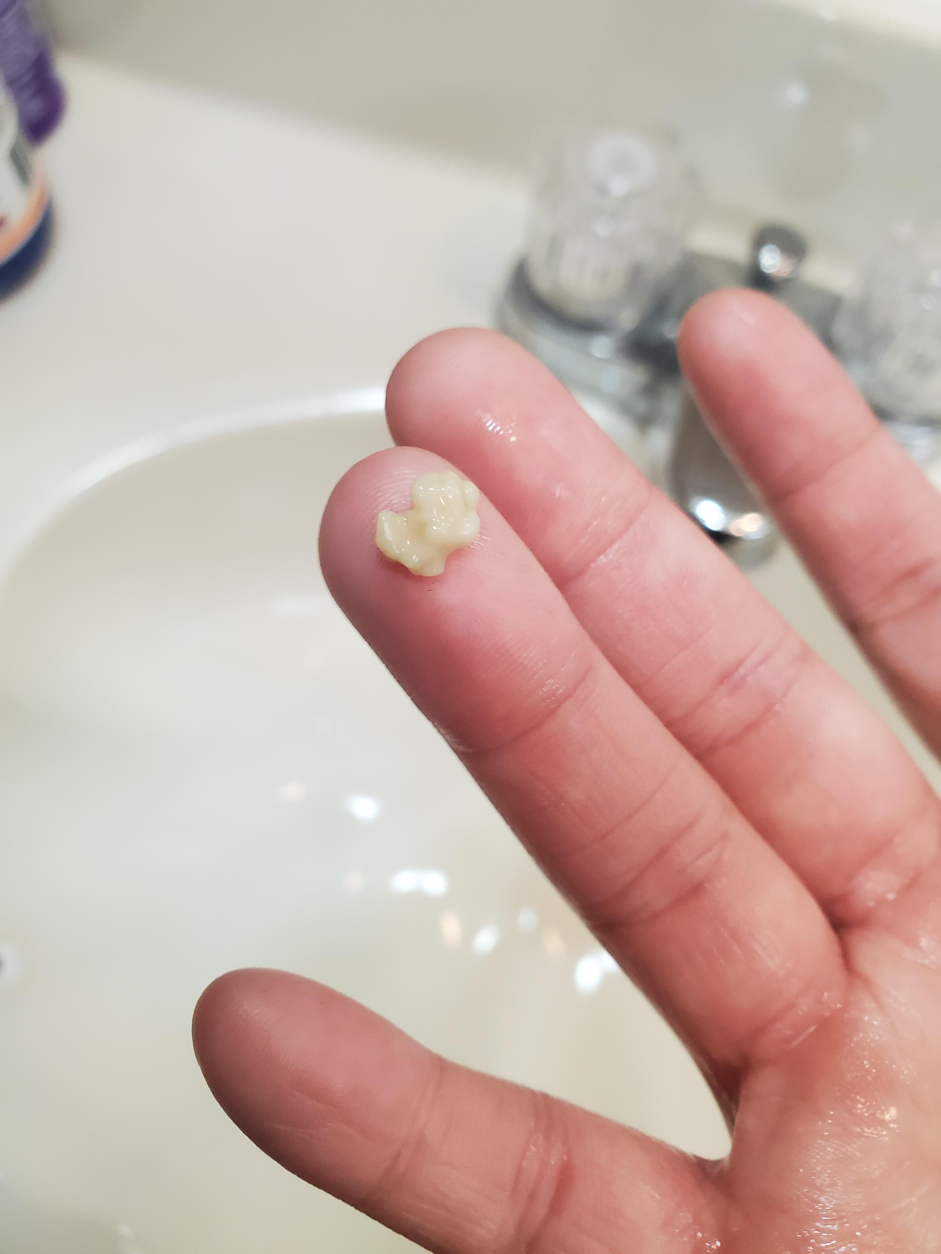 The biggest tonsil stone I have ever produced! tonsilstones