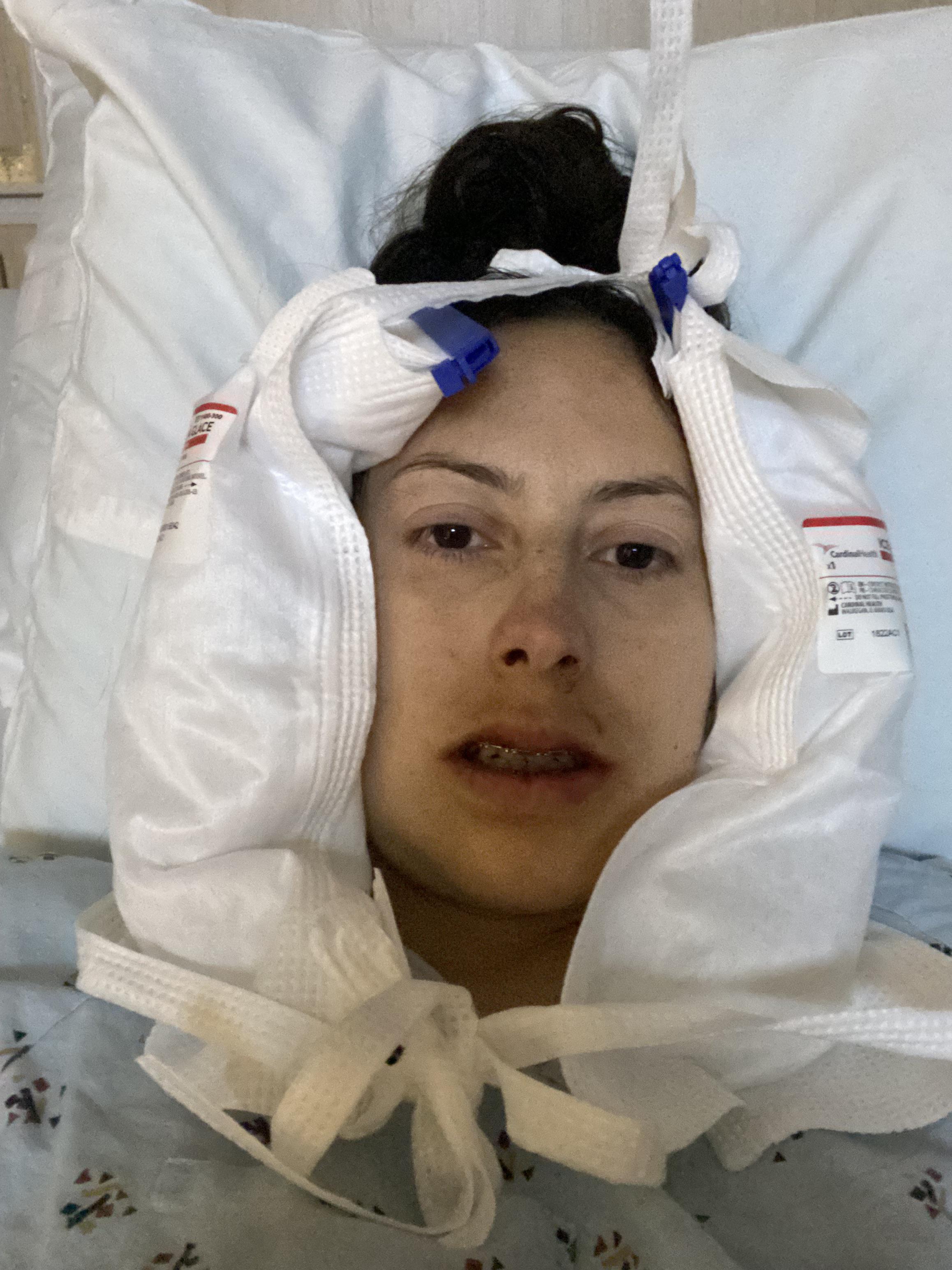 Double jaw surgery procedure yesterday r/jawsurgery