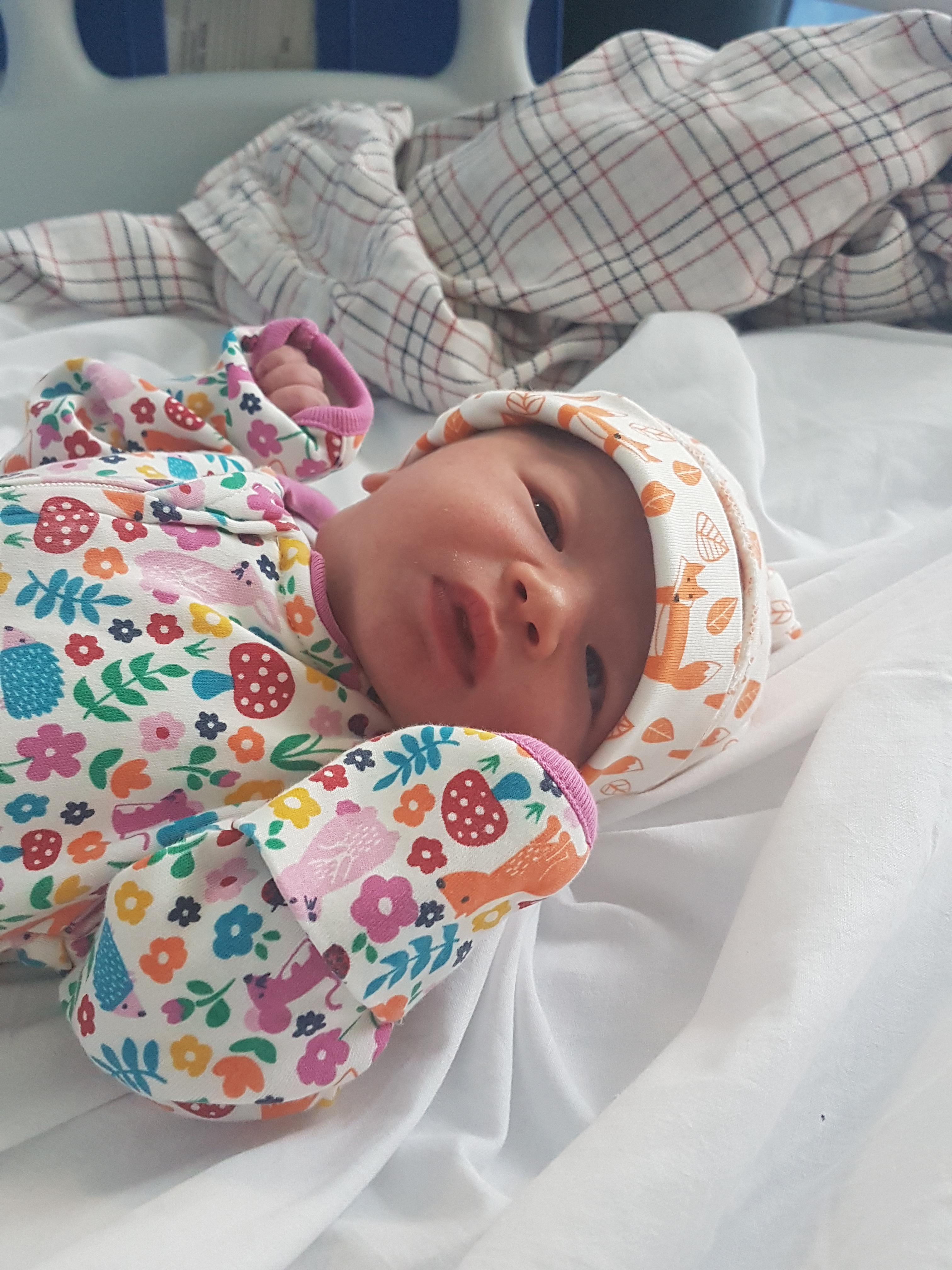 Balloon Induction First Baby at Dennis Hindman blog