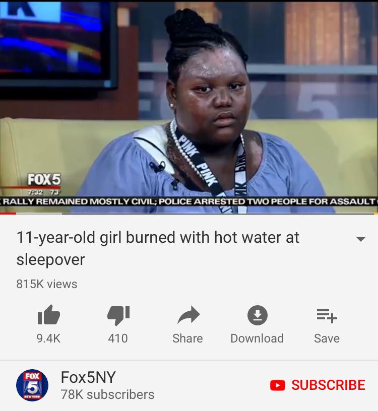 POS Friends pour boiling hot water on girl’s face for sleeping r/iamatotalpieceofshit