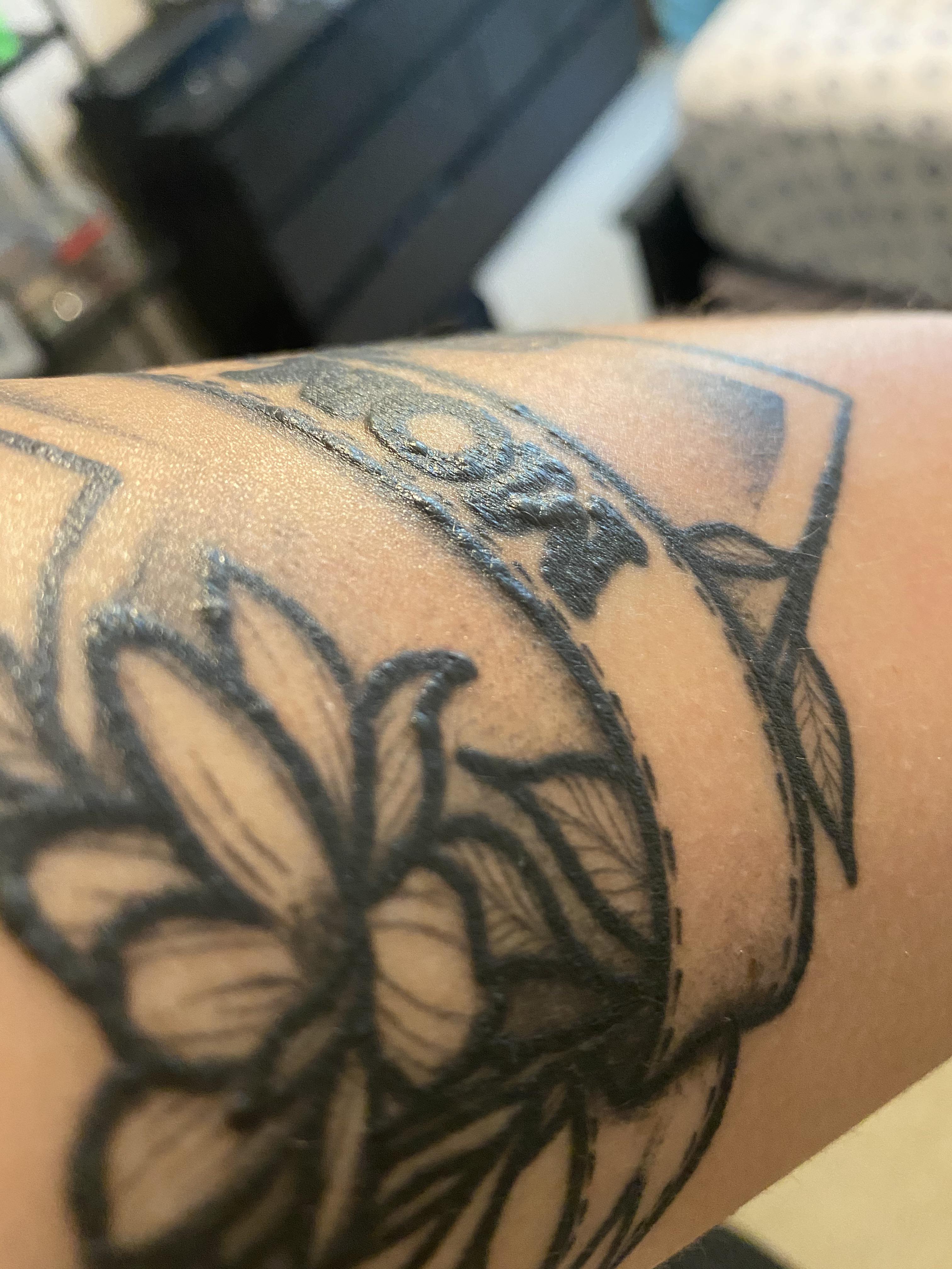 Any idea why I have these bumps under the ink of my tattoo? It is