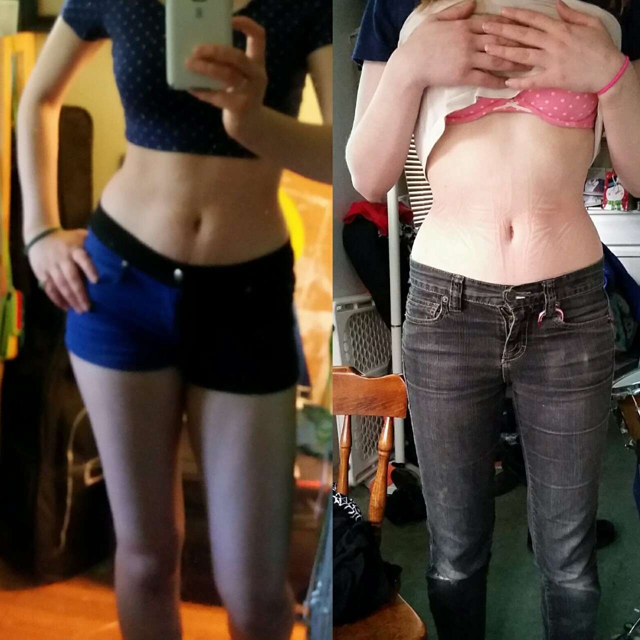 Beforw and after waist training for 6 months. My weight stayed the same
