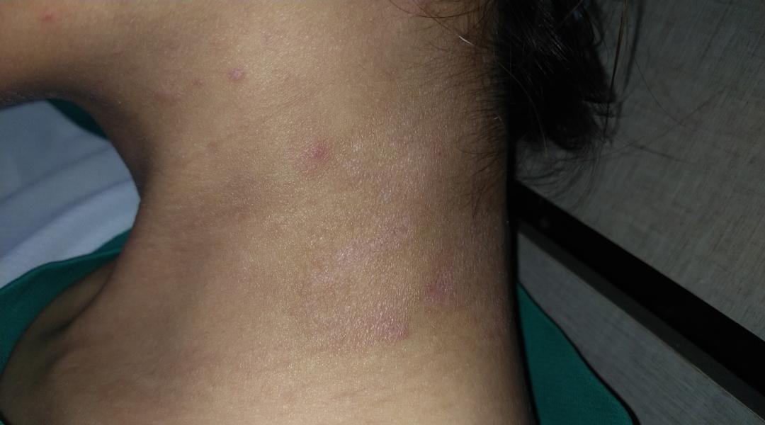 anyone know what this is? its itchy, feels dry and has been spreading