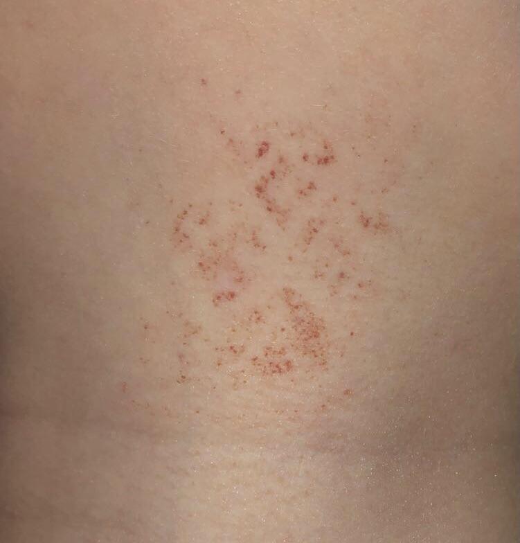 I’ve just noticed this which looks like a rash or bleeding under the