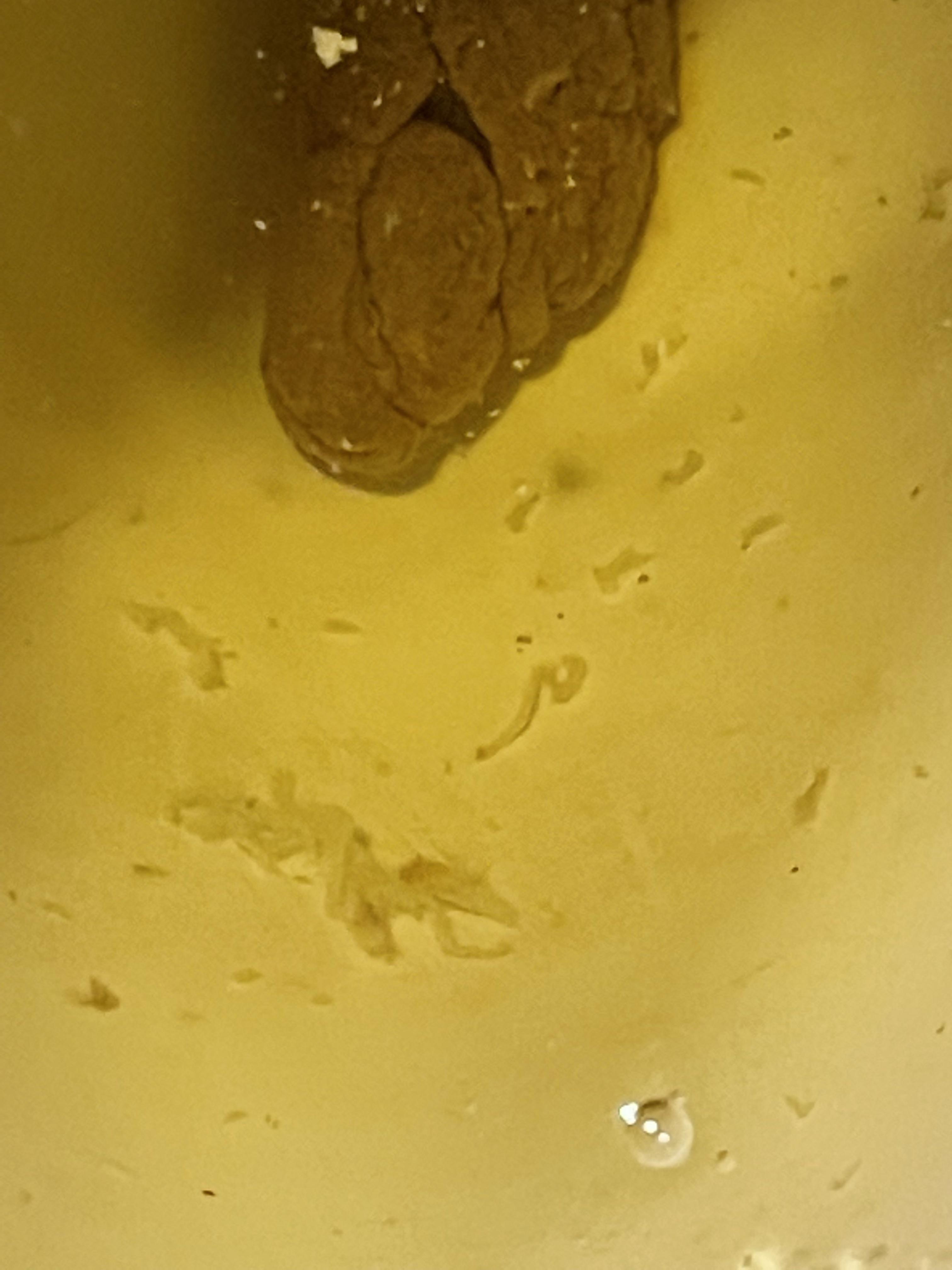 What is this in poop? candida or parasites? Started after taking garlic, grape seed, oregano oil