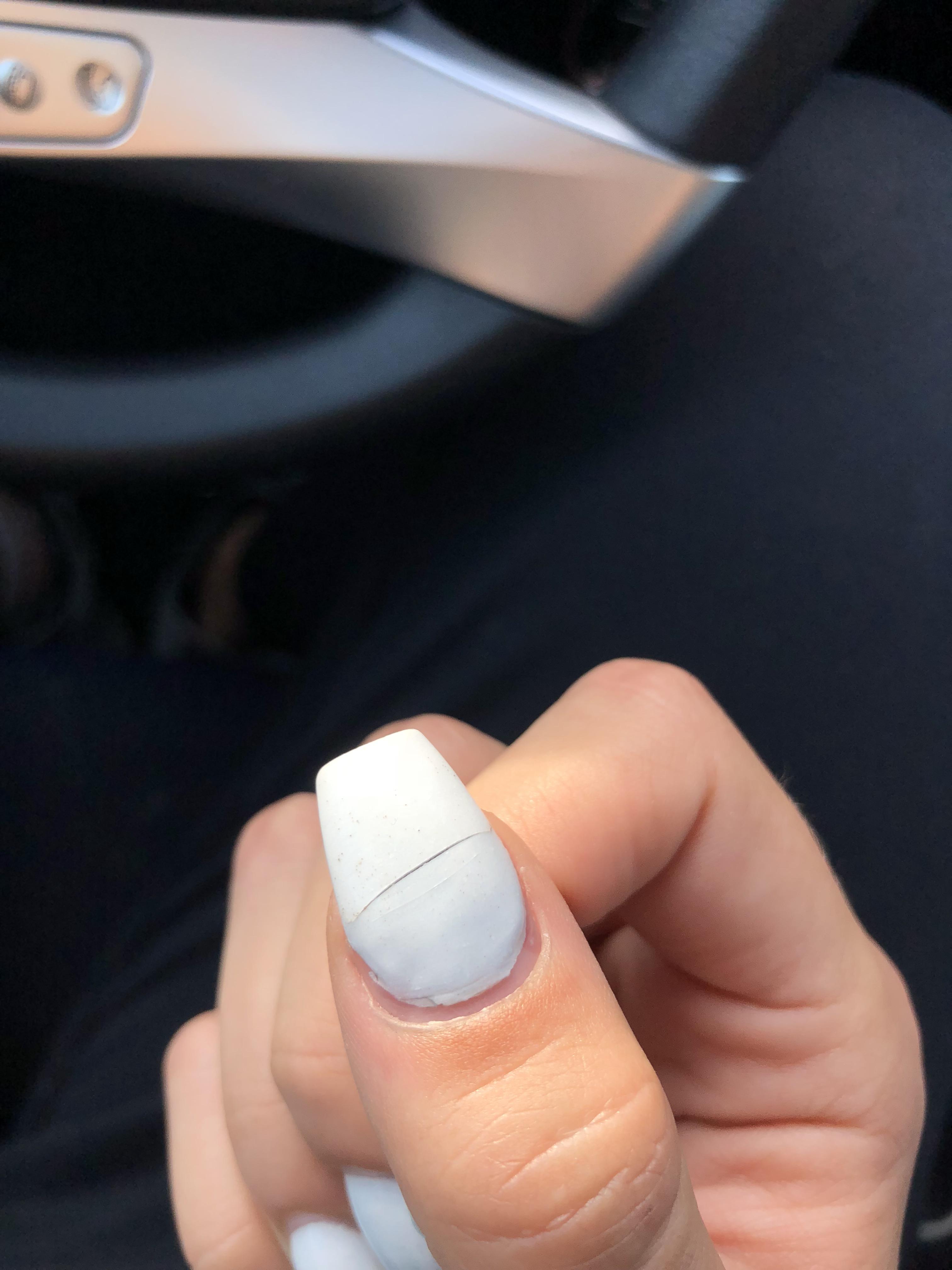 What’s the best course of action to fix this? Nails