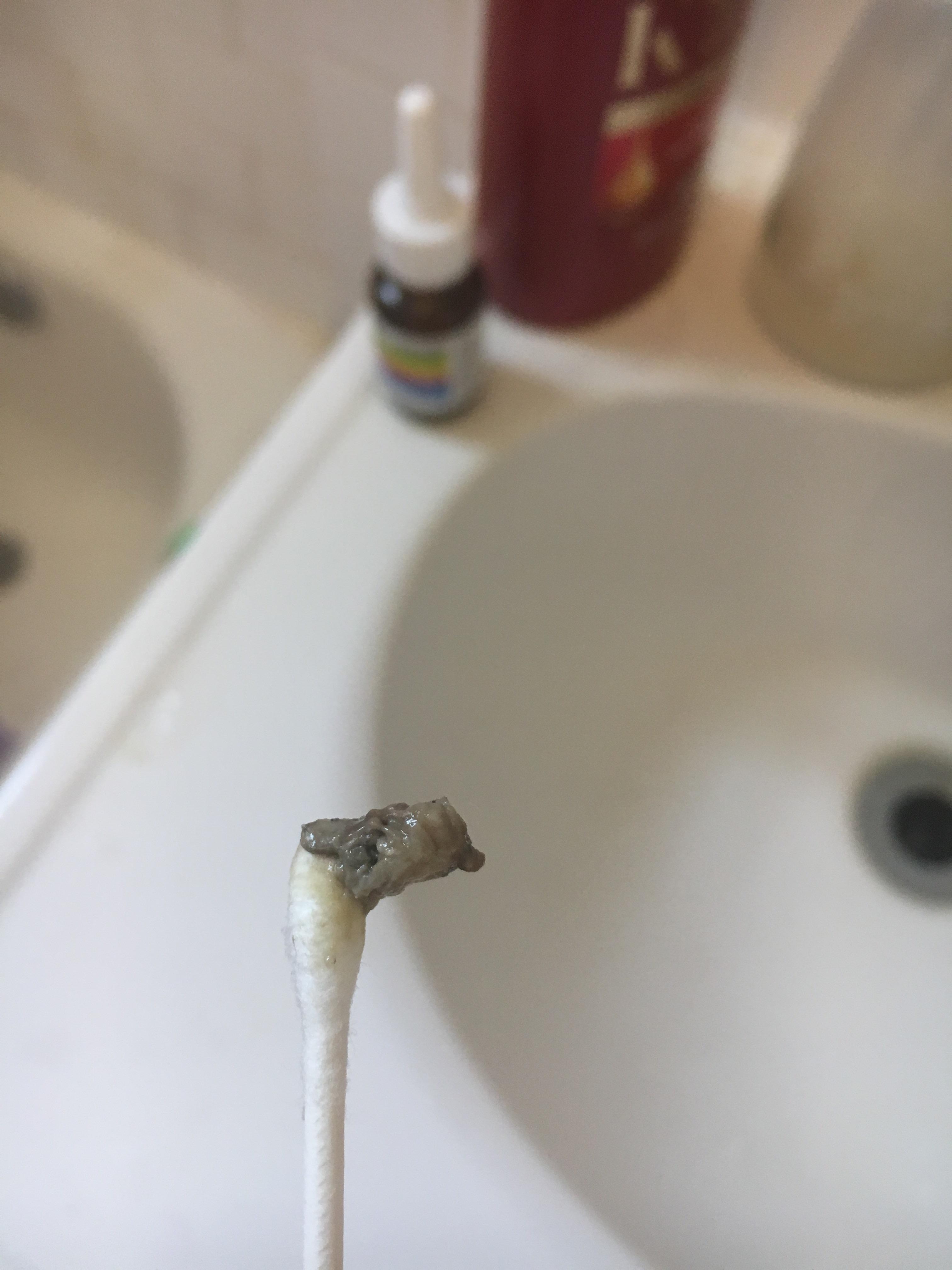 Five week ear infection finally starting to break up. I sneezed and