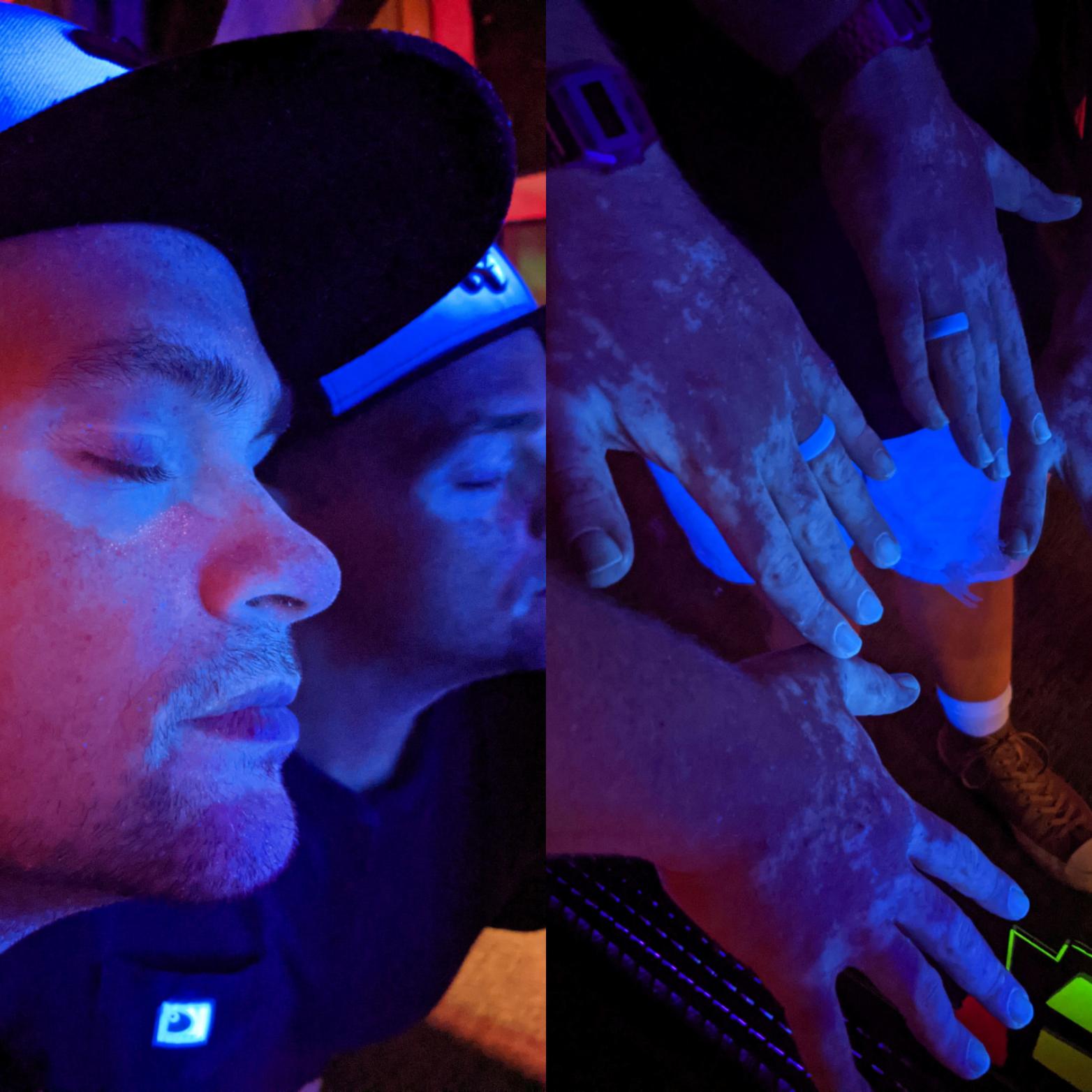 My face and hands under blacklight . r/Vitiligo
