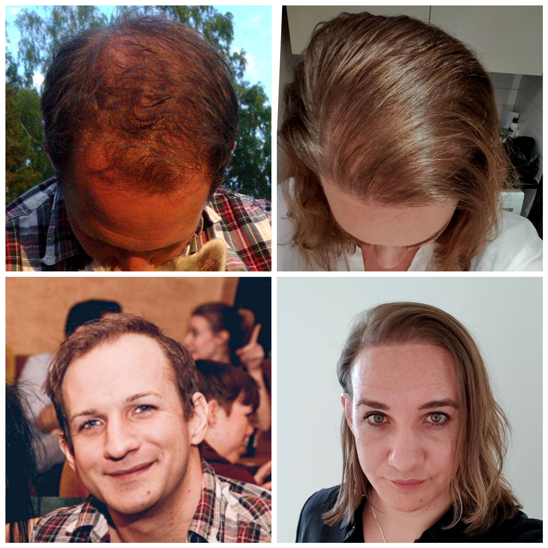 Hair timeline It's not perfect, but sparks so much more joy! ) a decade's worth of