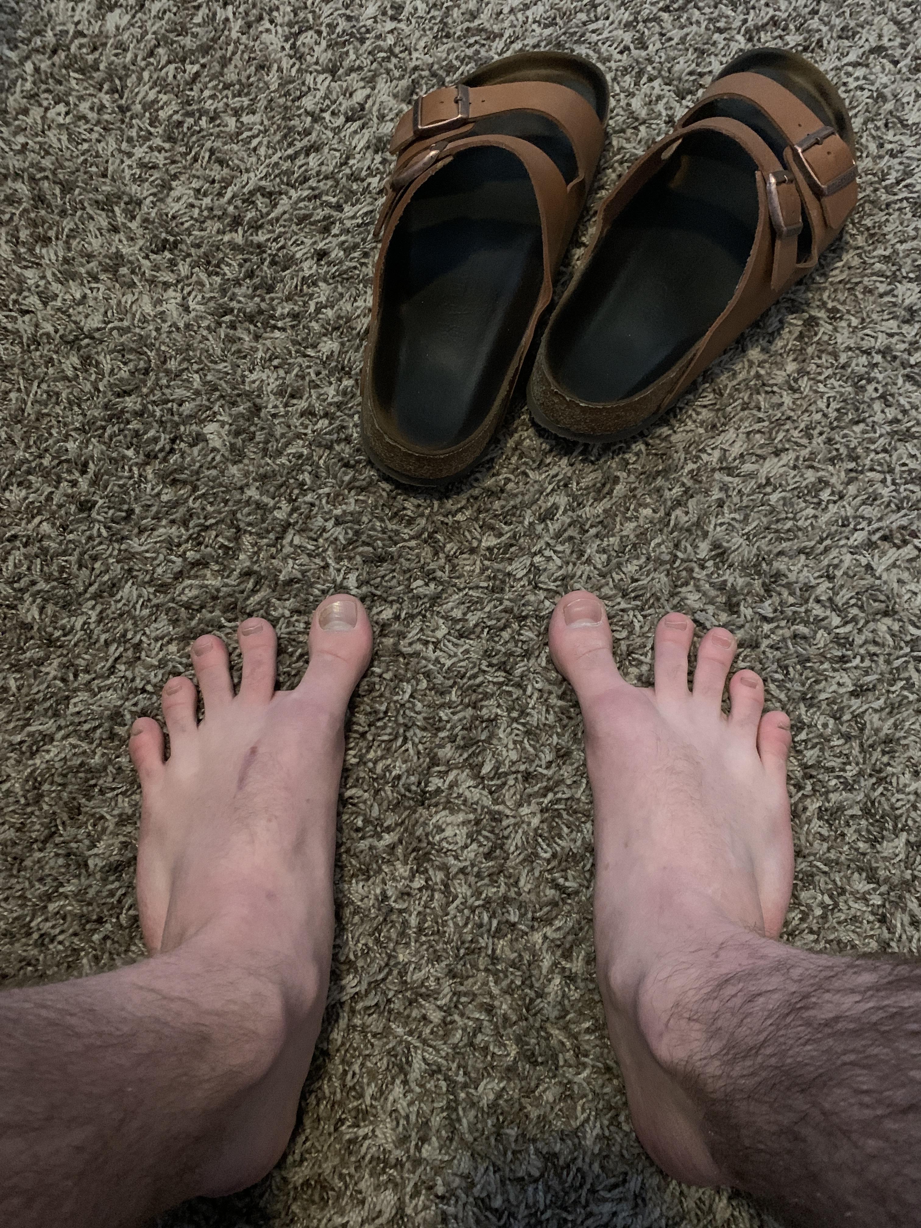 why are my feet like this? is it bad to have flat feet? why is there a big toe gap? r/FootFunction