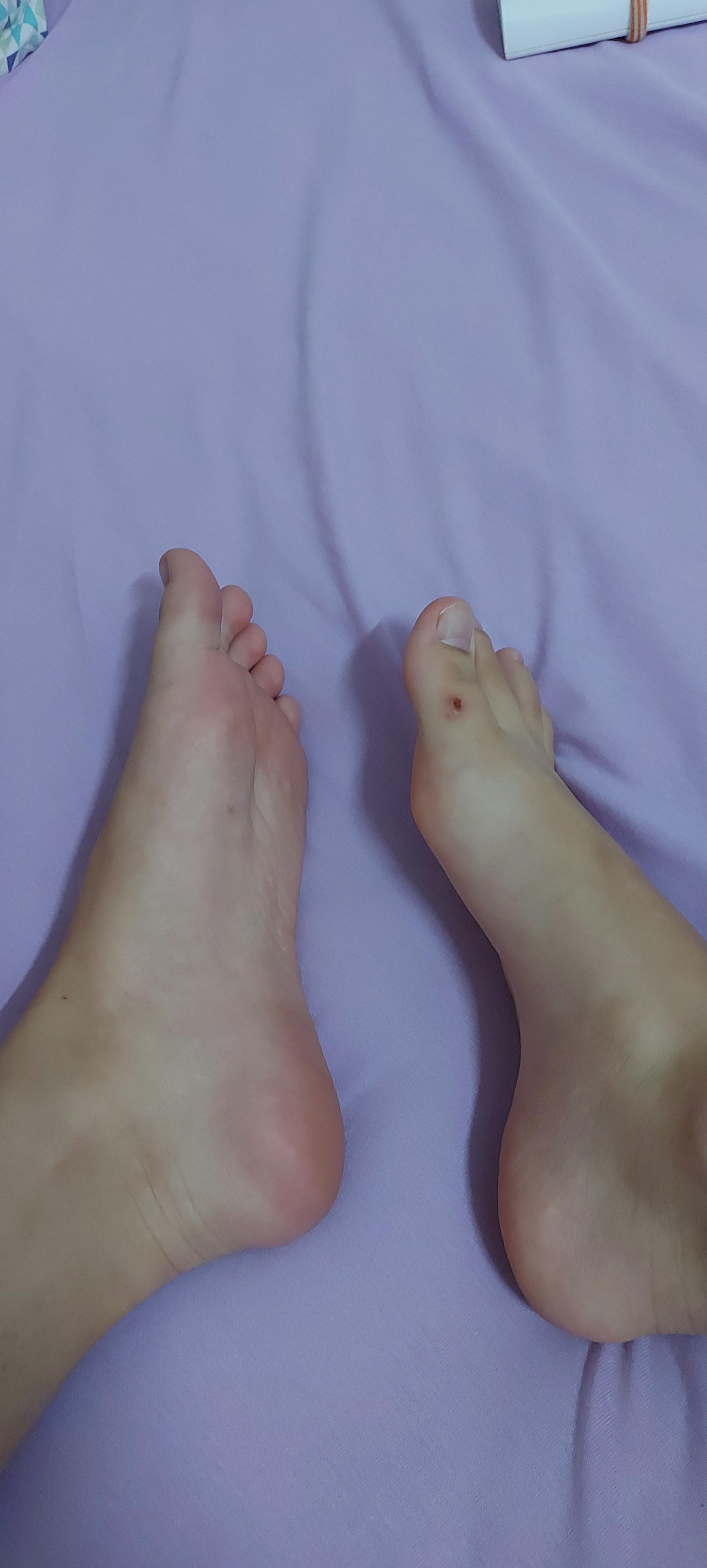 I hurt my feet today, someone to take care of them? 😕 r/FootTalk