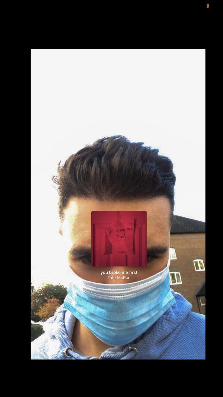 Hair hurts to the touch tressless