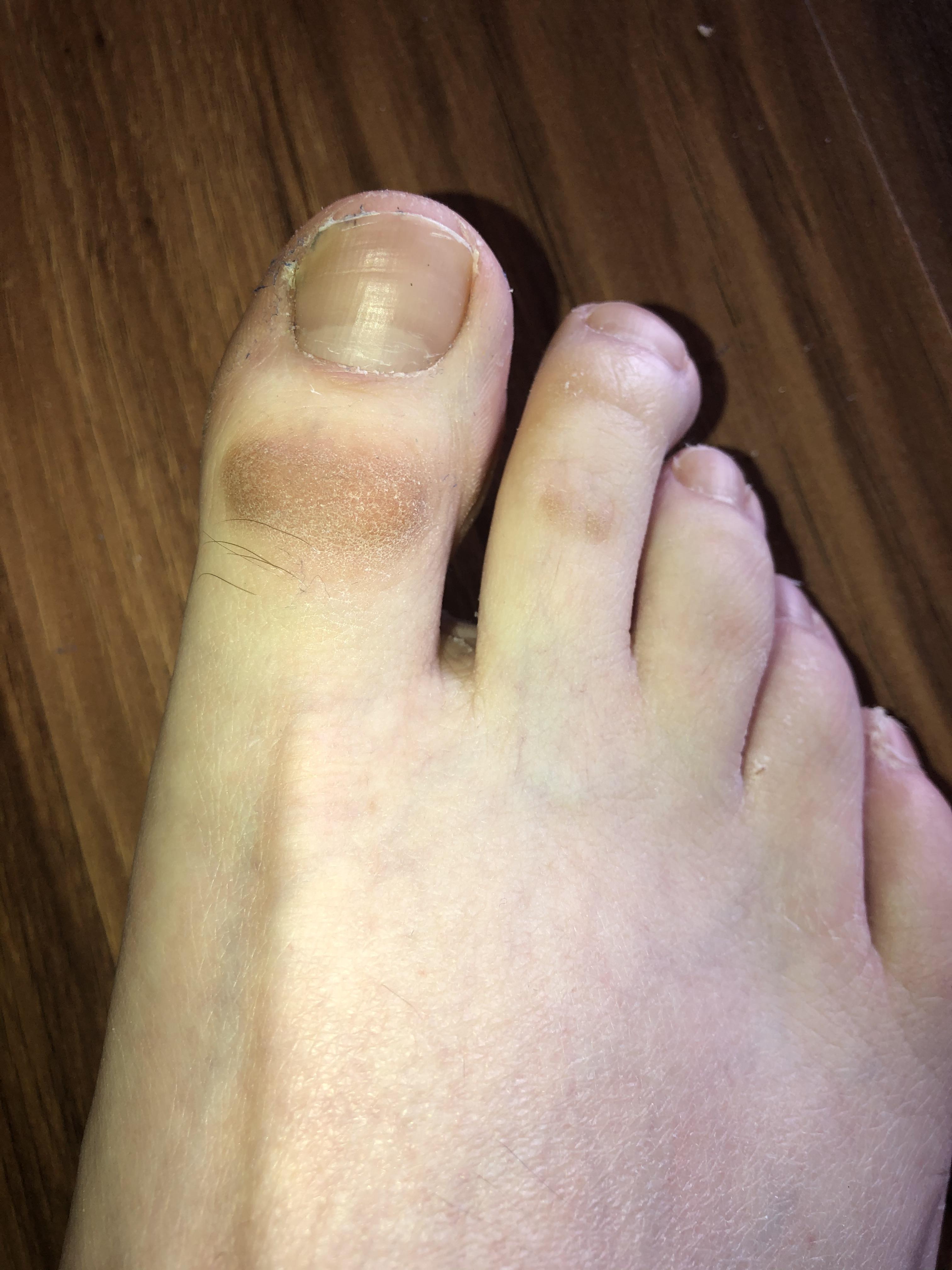 What Causes Skin Discoloration? How To Treat Skin Discoloration Soft