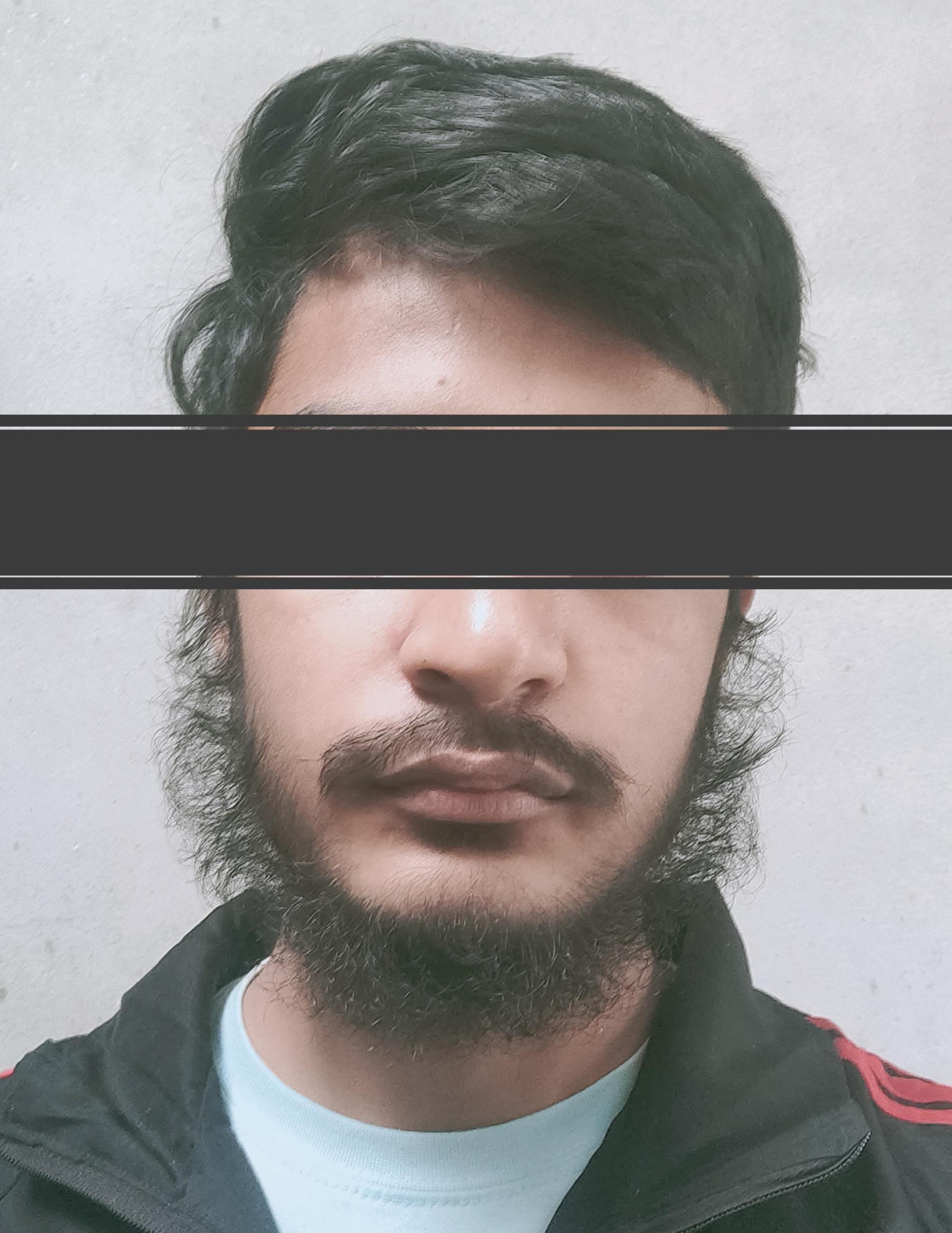 17, M just starting to grow. I have never shaved from the skin but only