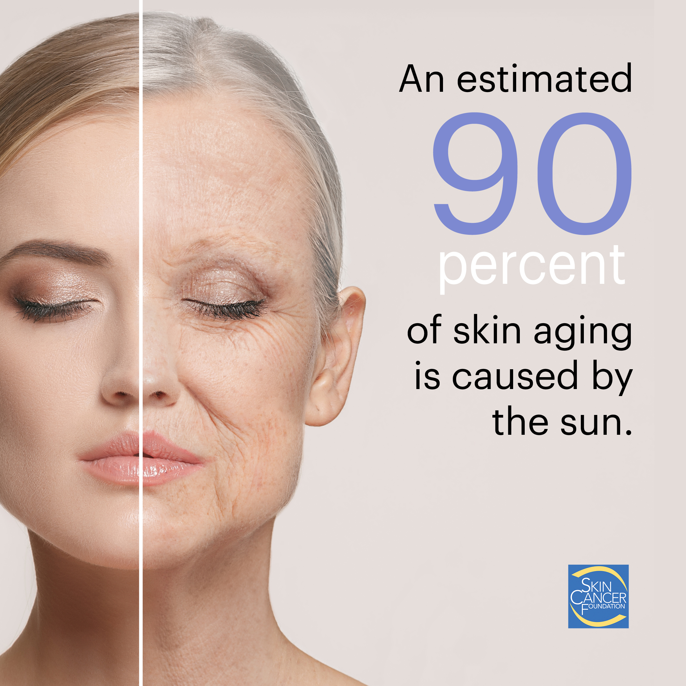 Top 99+ Pictures Pictures Of Sun Poisoning On Skin Completed