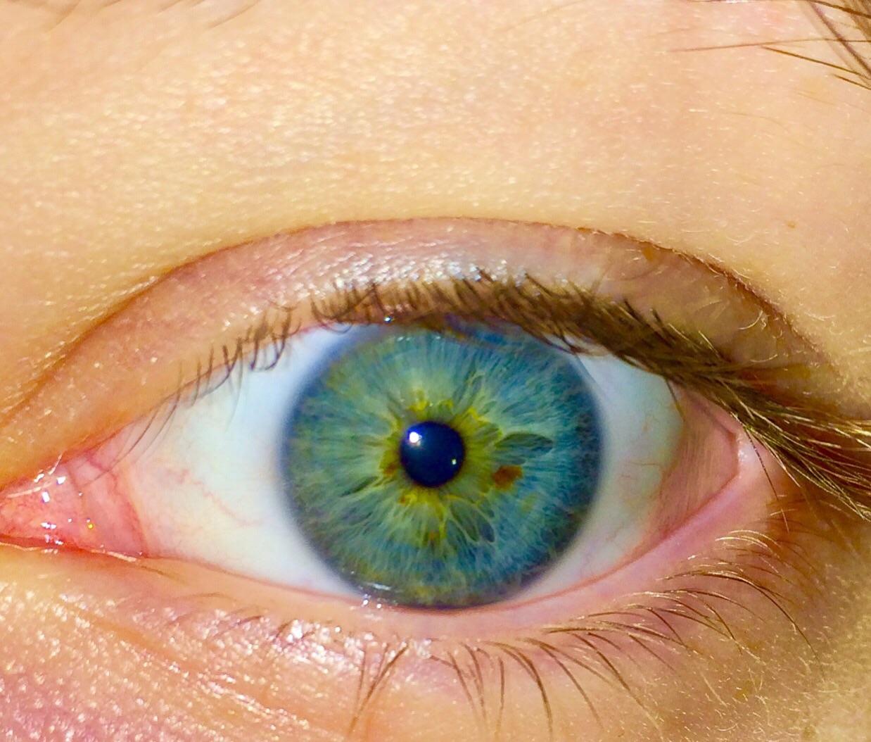 my left eye with brown dots r/eyes
