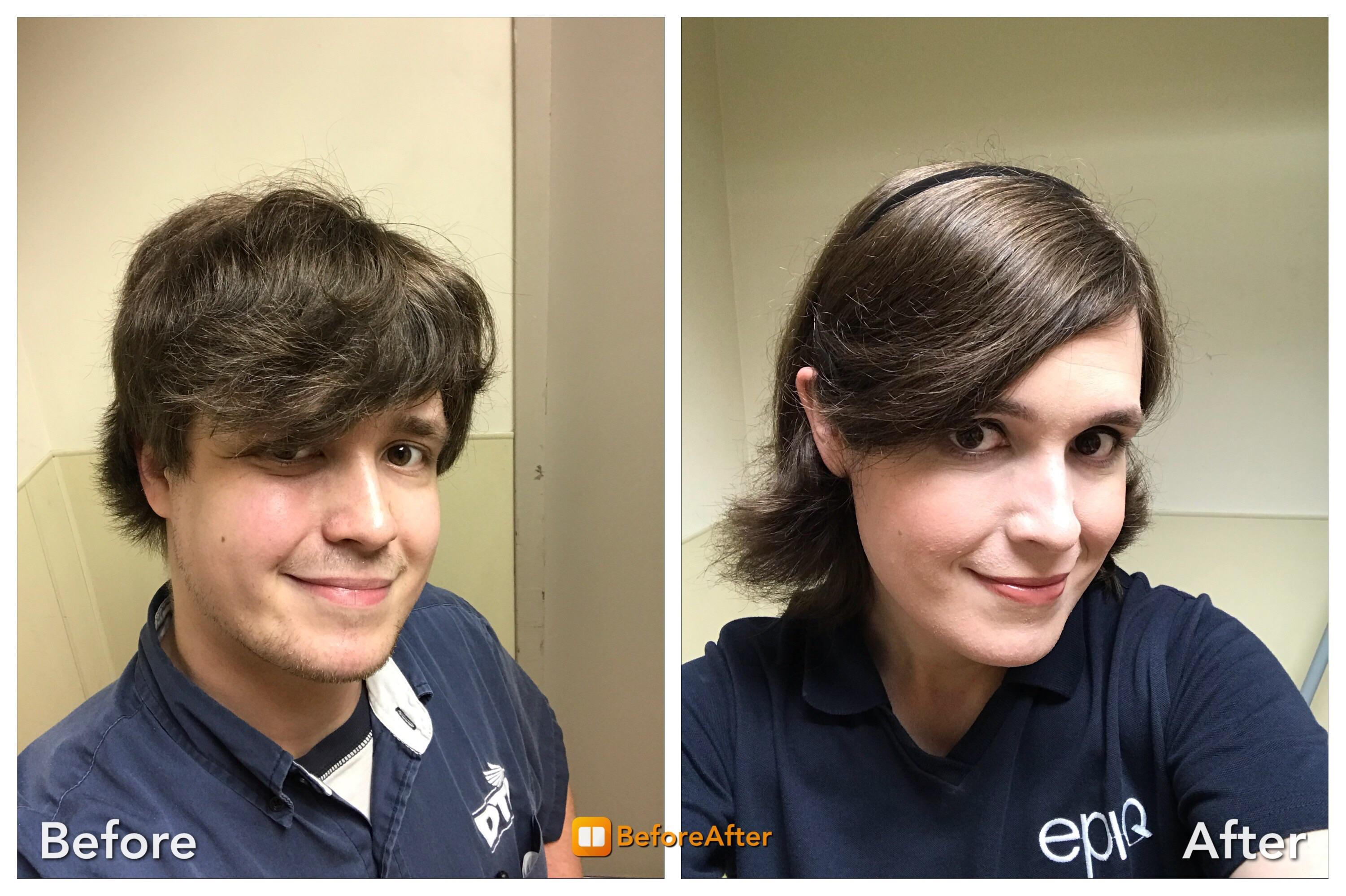 Estrogen Before And After