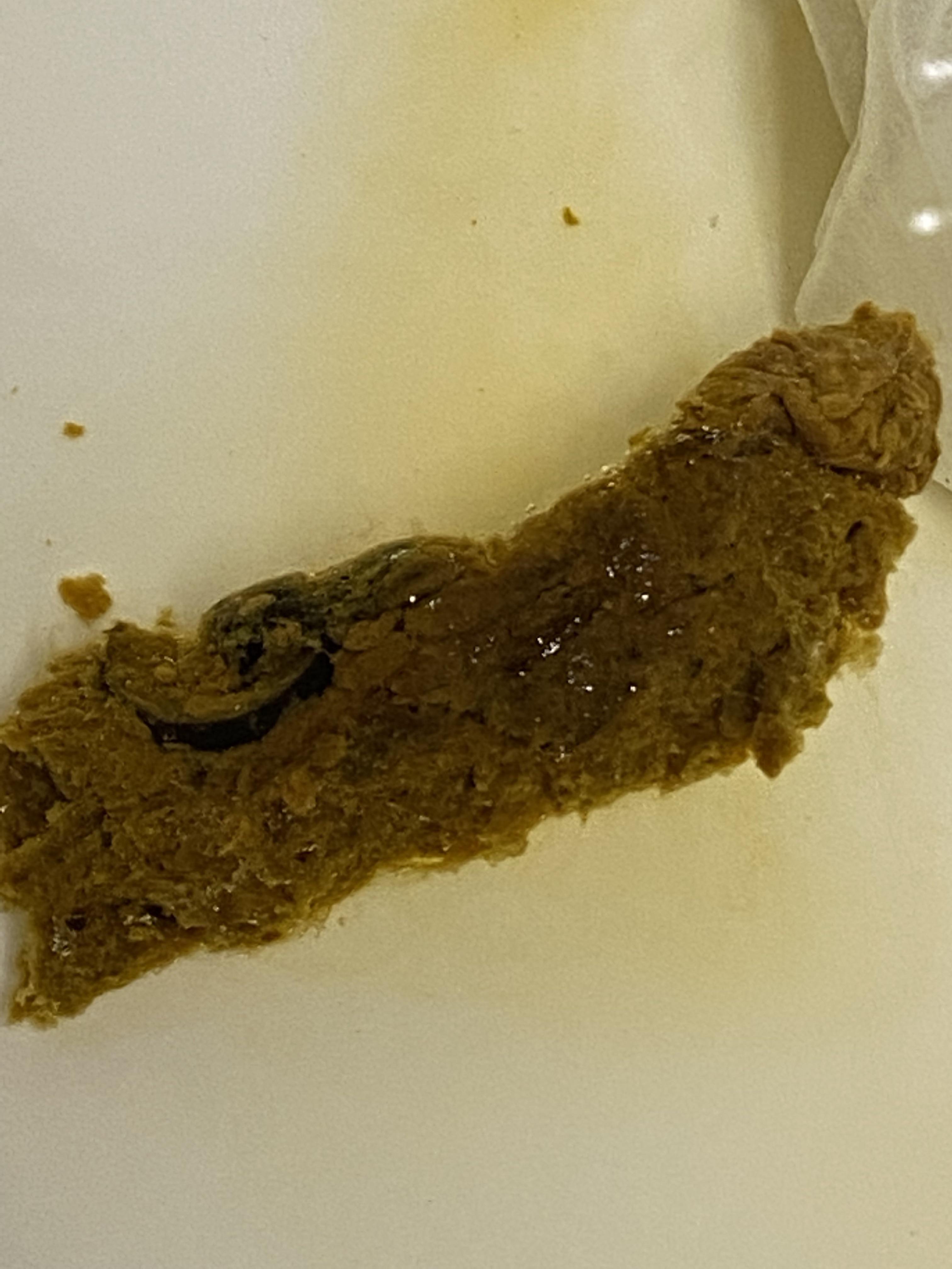 Undigested food or Colon issues? r/poop