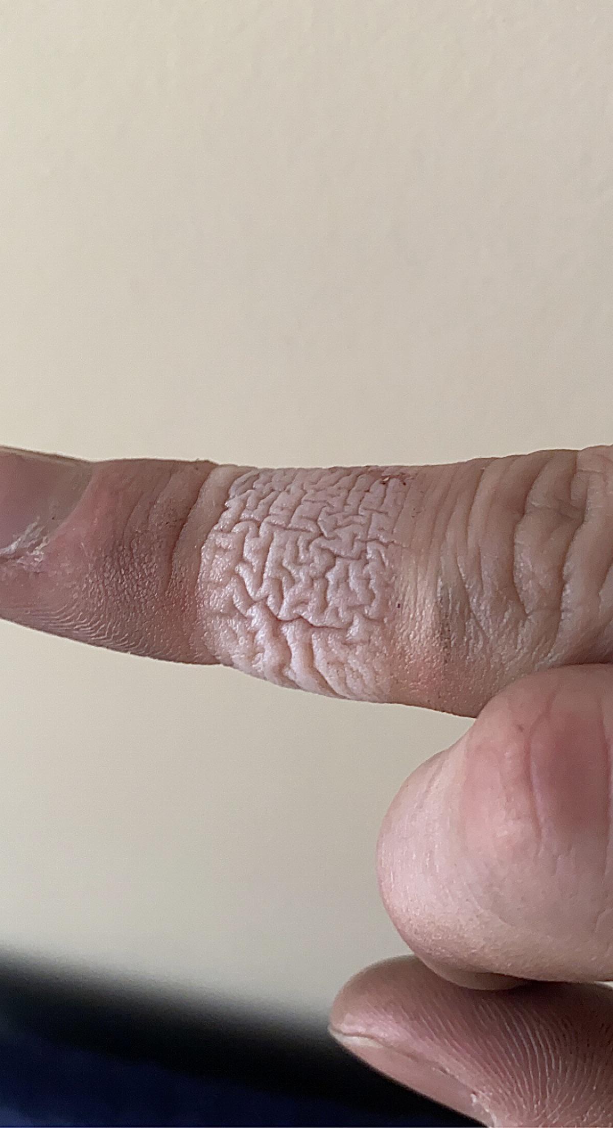 These wrinkles on my finger after I removed a bandaid r/mildlyinteresting