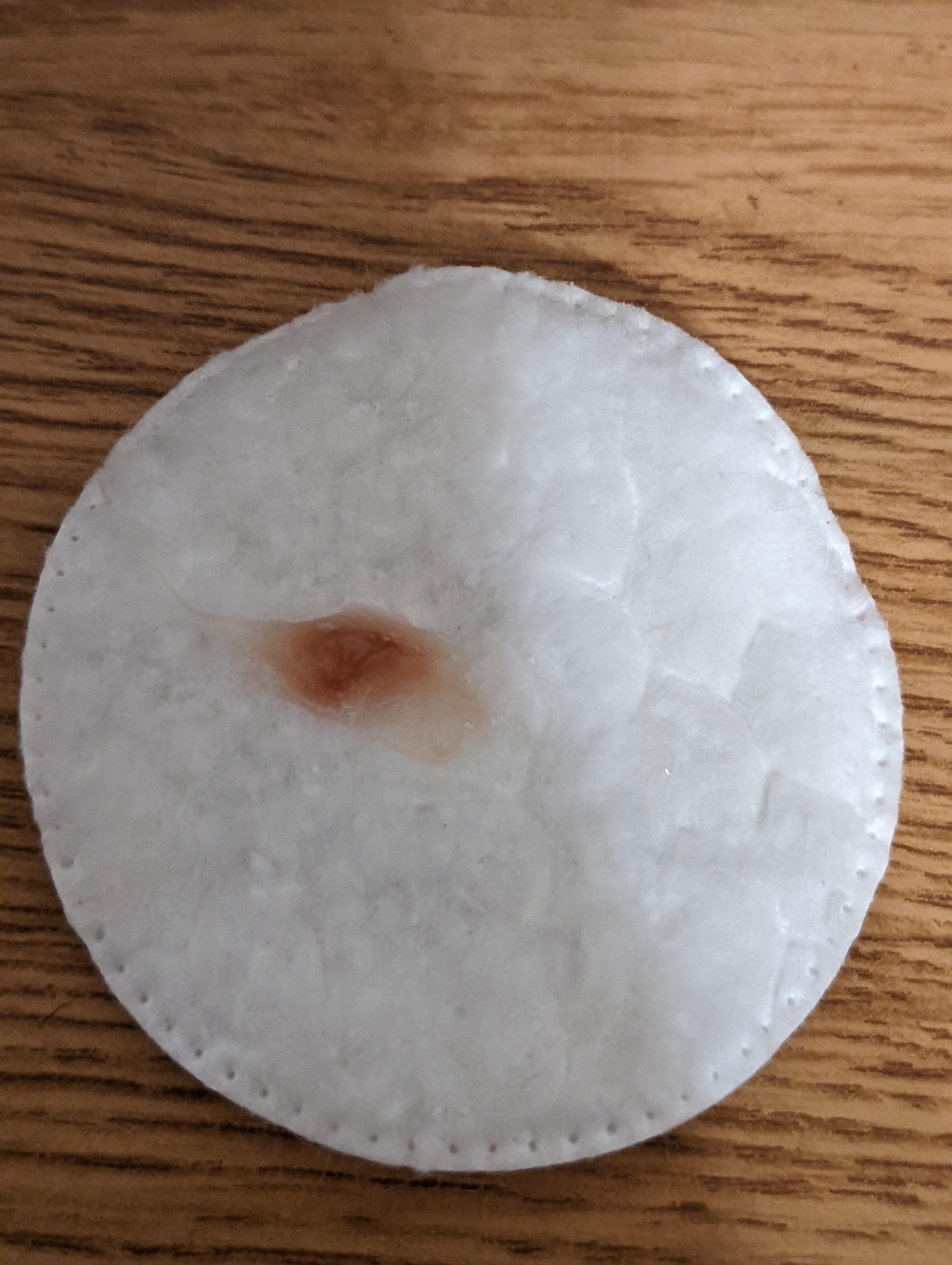 coughing up red/brown chunks of mucous r/medical