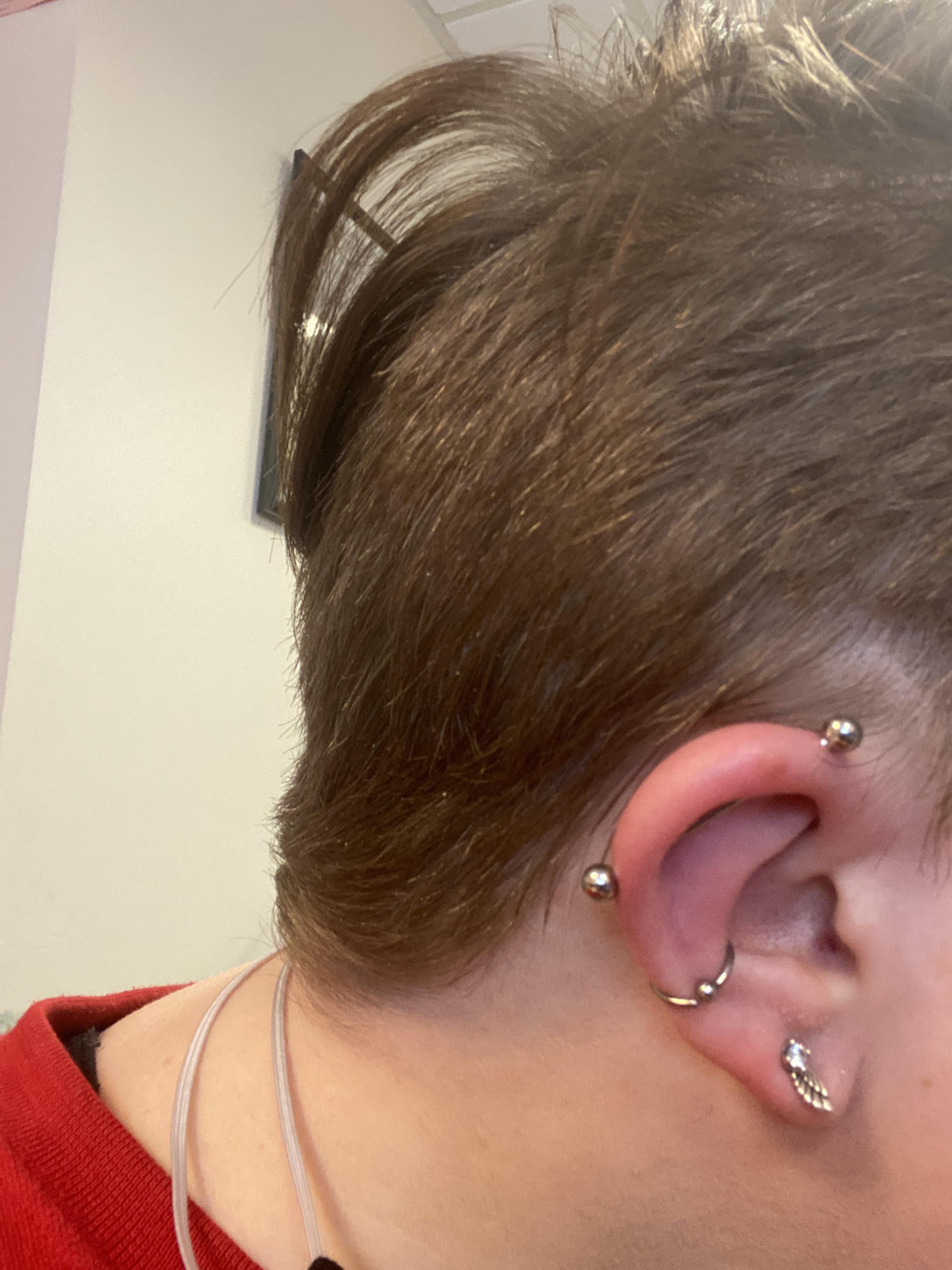 5 days post Industrial. Does this look okay? It’s red and only hurts on