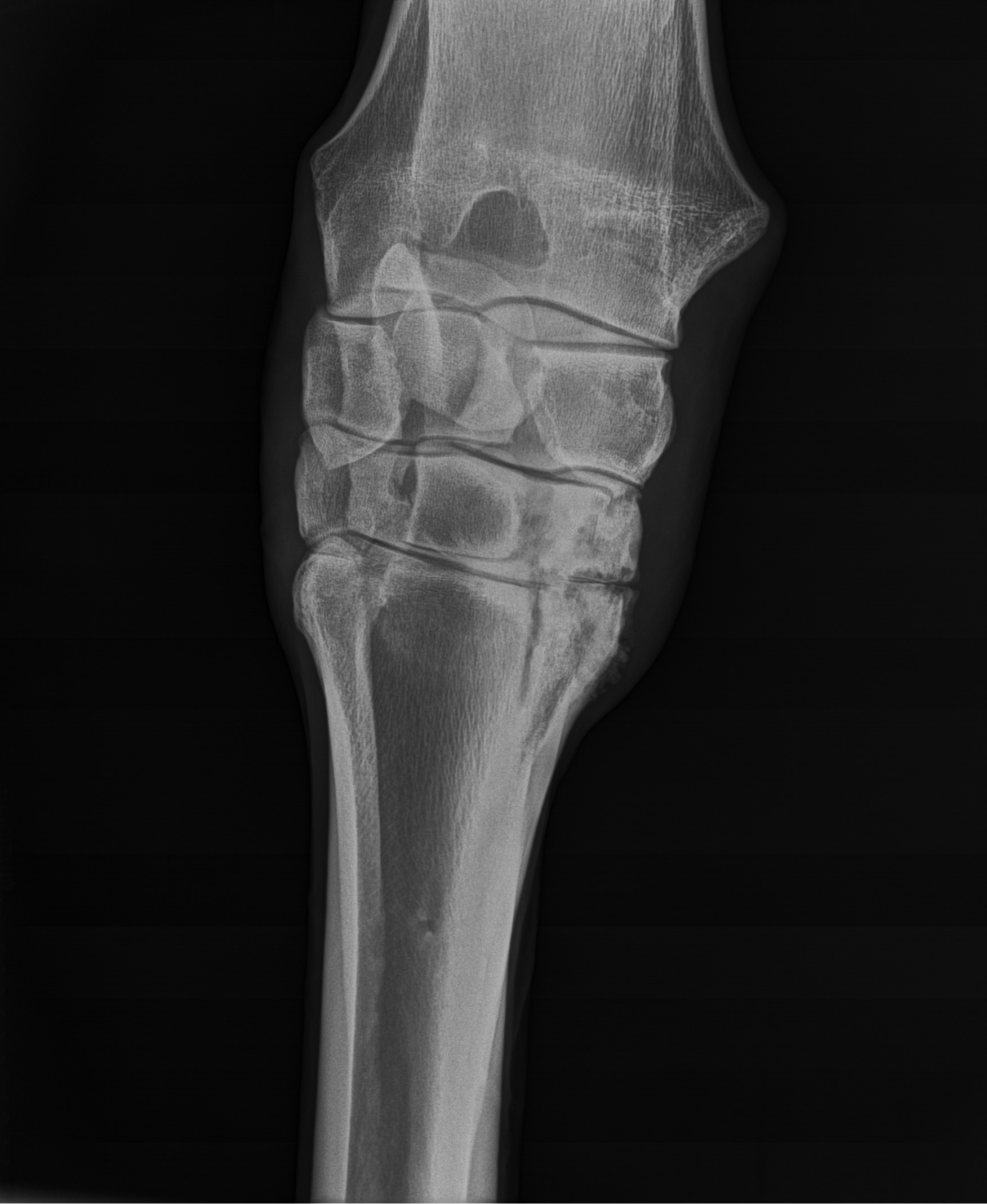 Sharing X ray pictures of a lease horse I have Stress fracture to