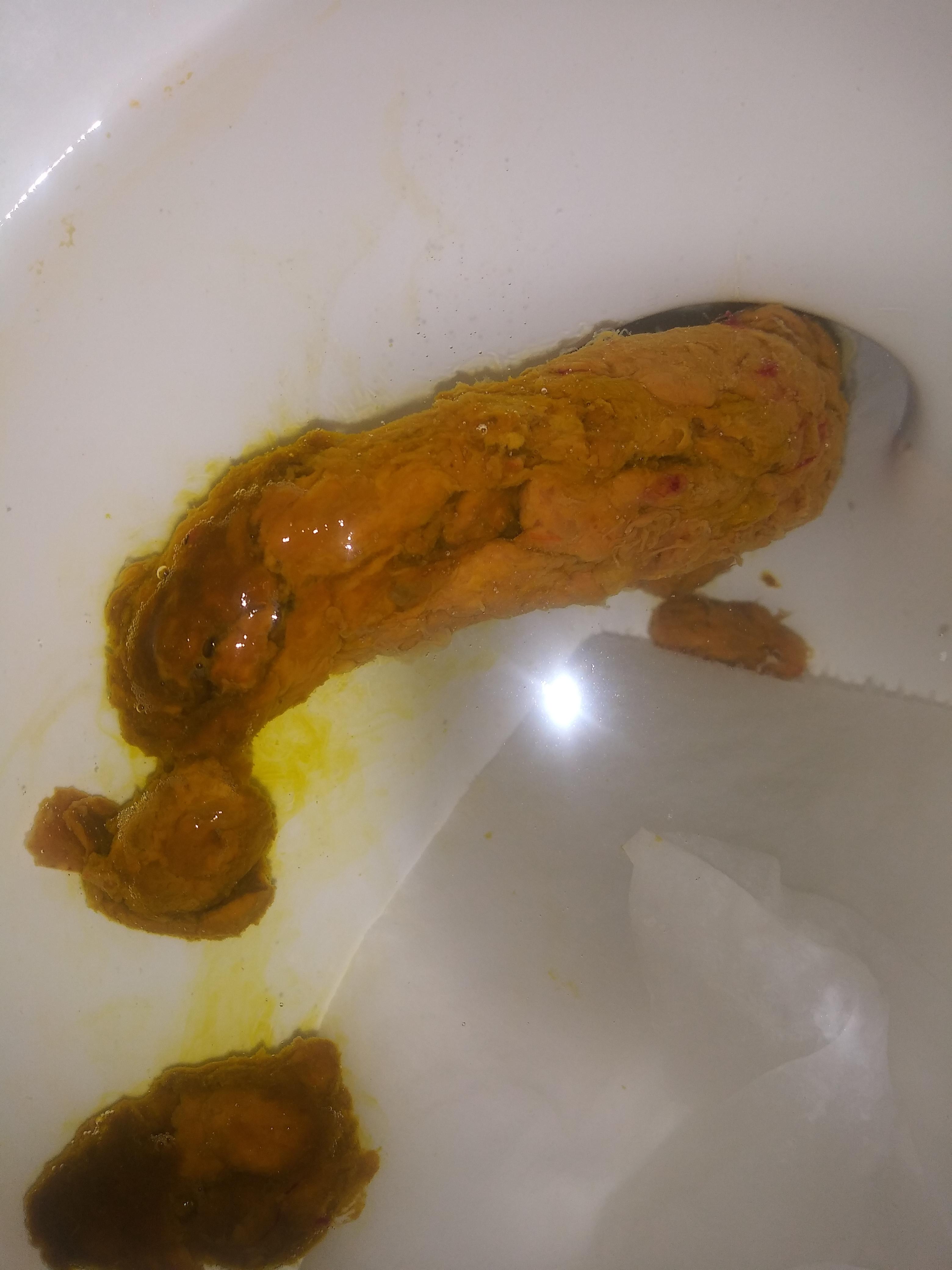 Blood? r/poop