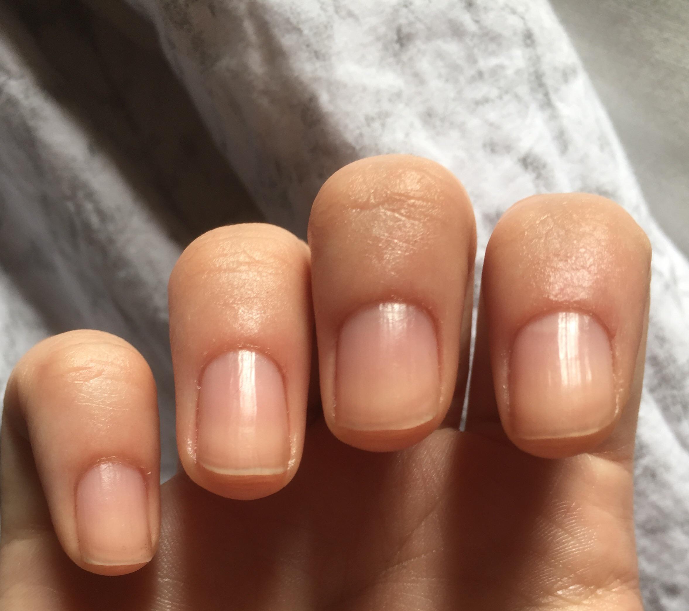 Stopped biting my nails for good. You guys need to get cuticle oil, it