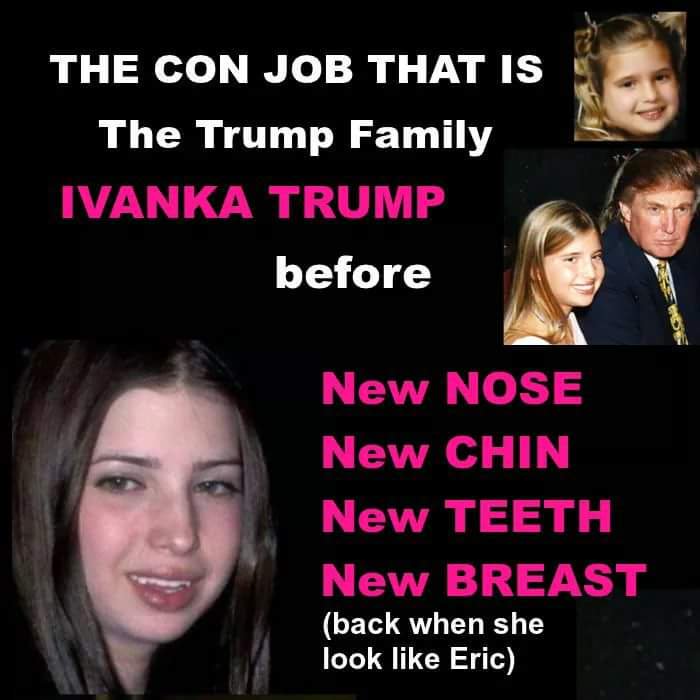 Plastic Surgery memes