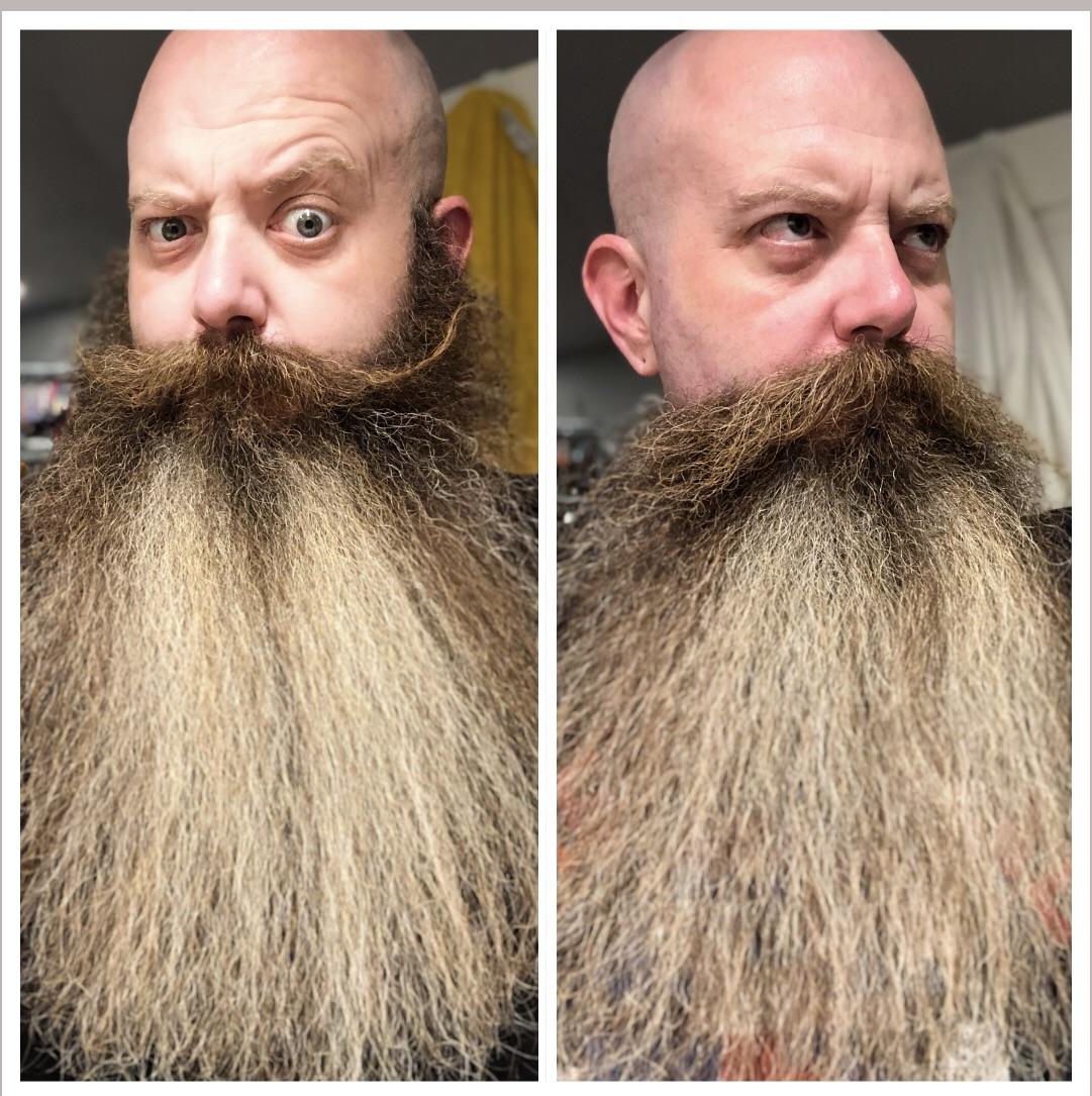 New Year, new beard. I shaved my cheeks off. Now I have a massive