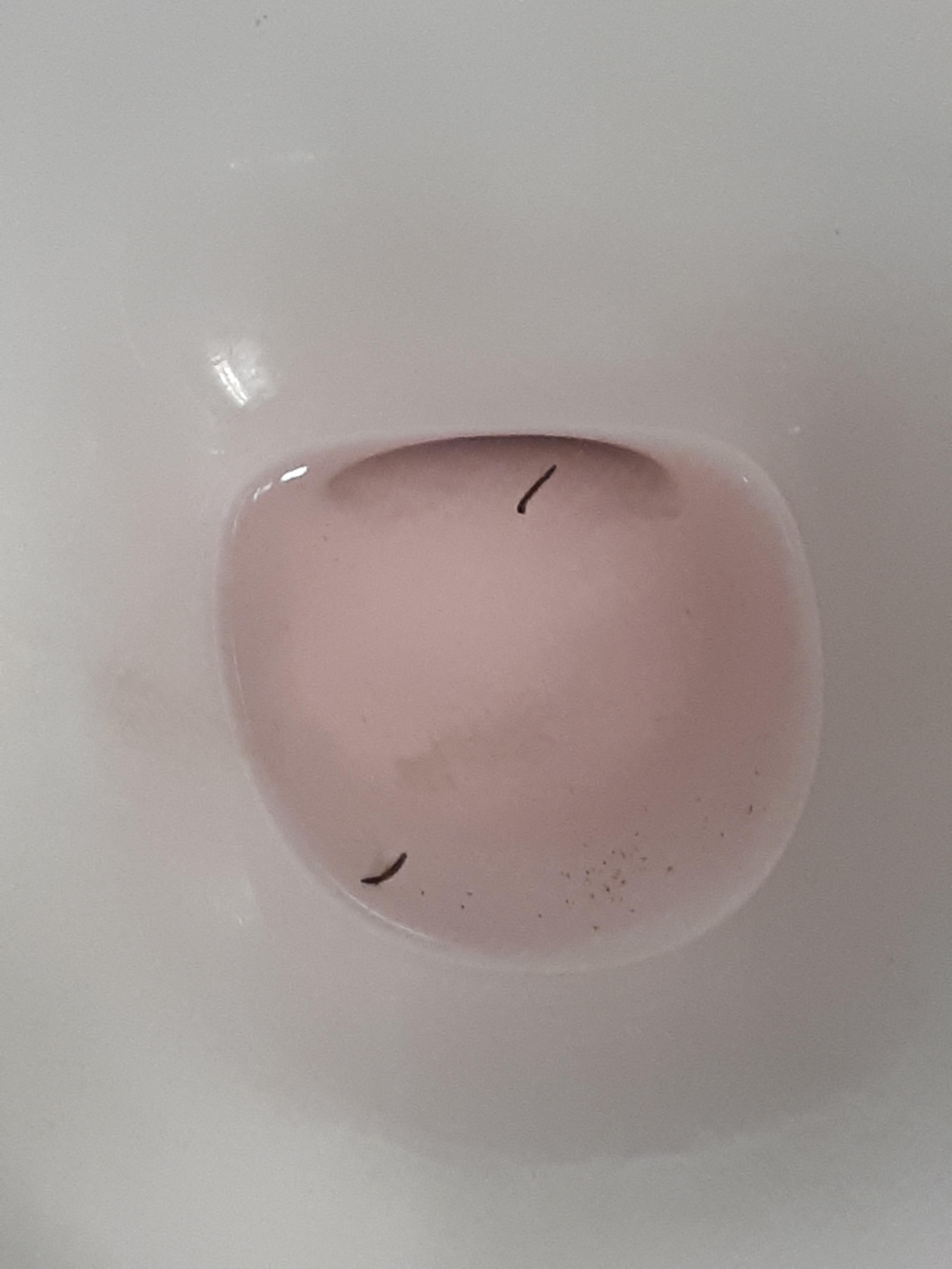 What are these Black worms in urinal? They move around and live r