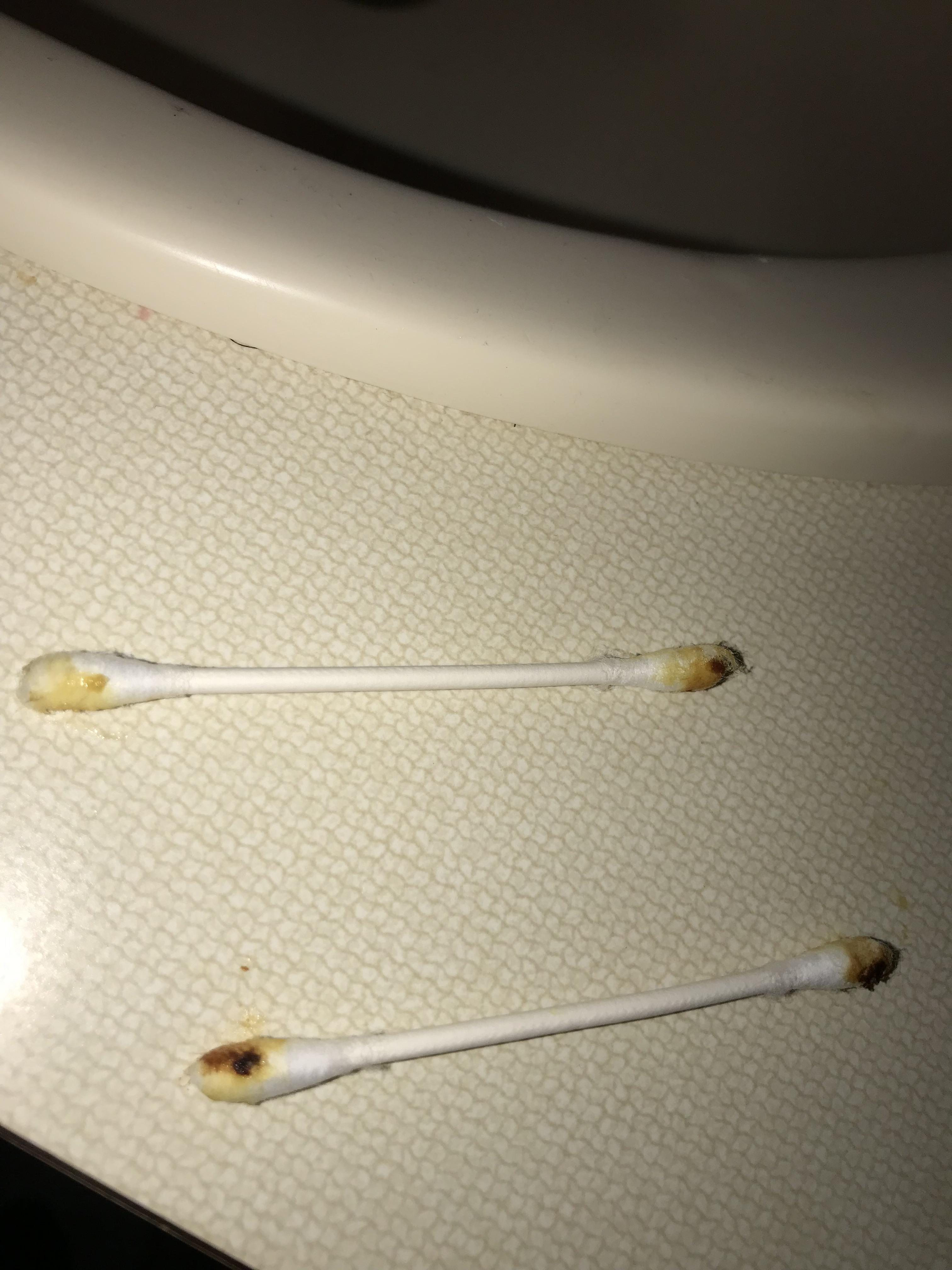 I Qtip my ears every 23 nights, and they always look like this. r