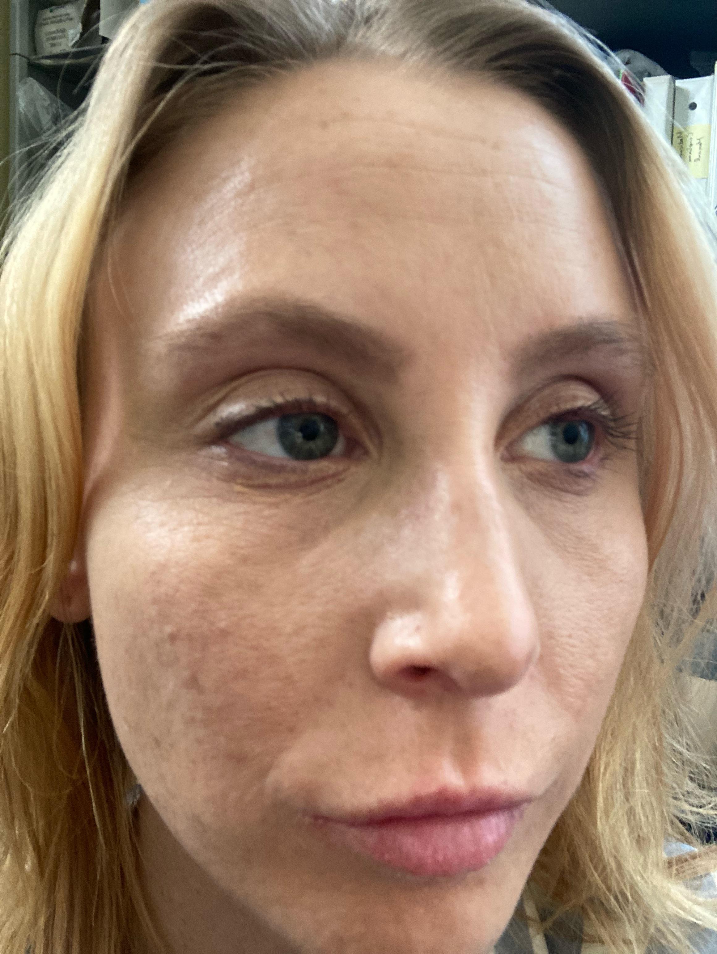 29 and skin is so elastic looking? It’s new and awful. Feels tight too