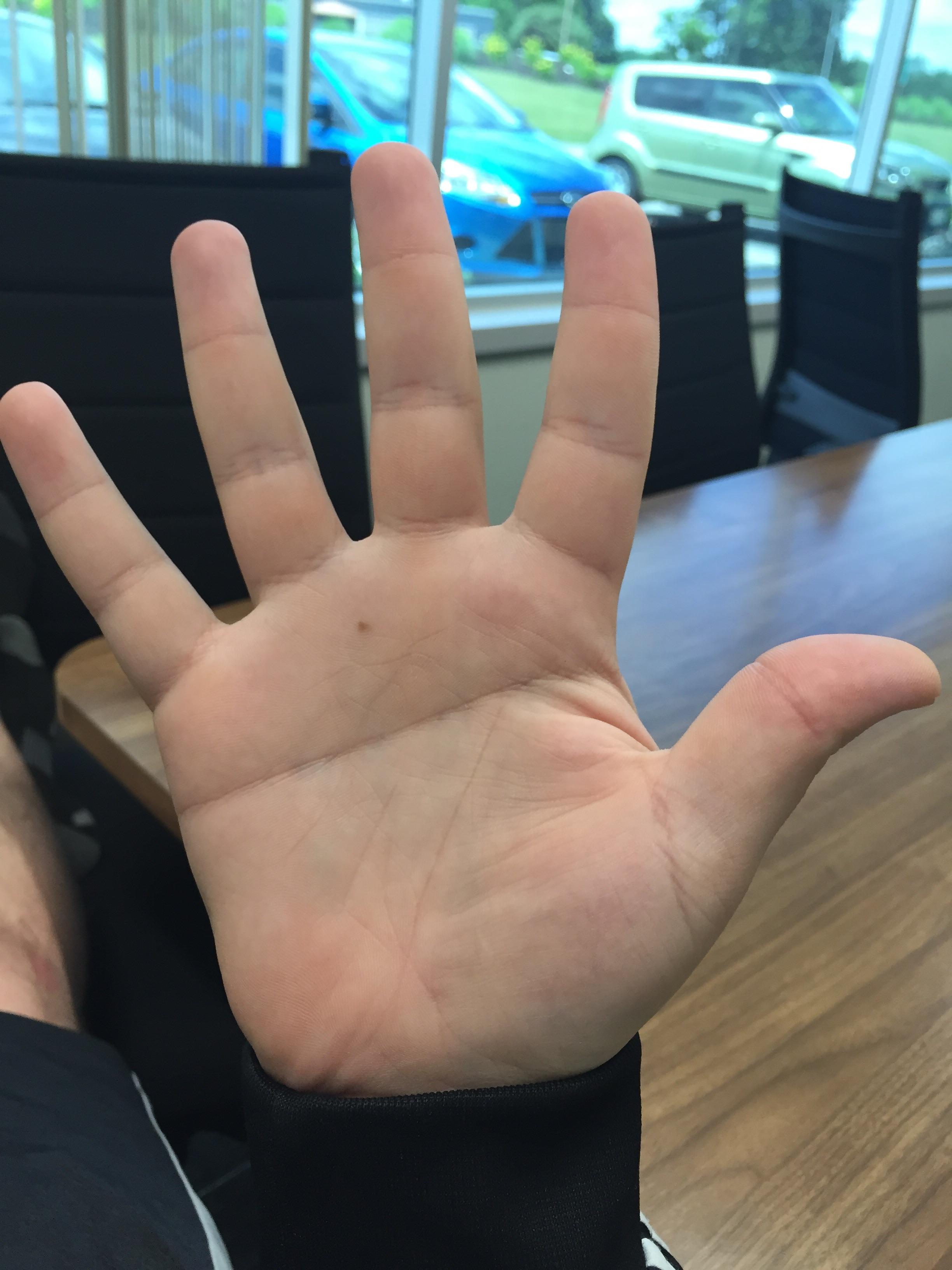 I have a single line across my palm r/mildlyinteresting