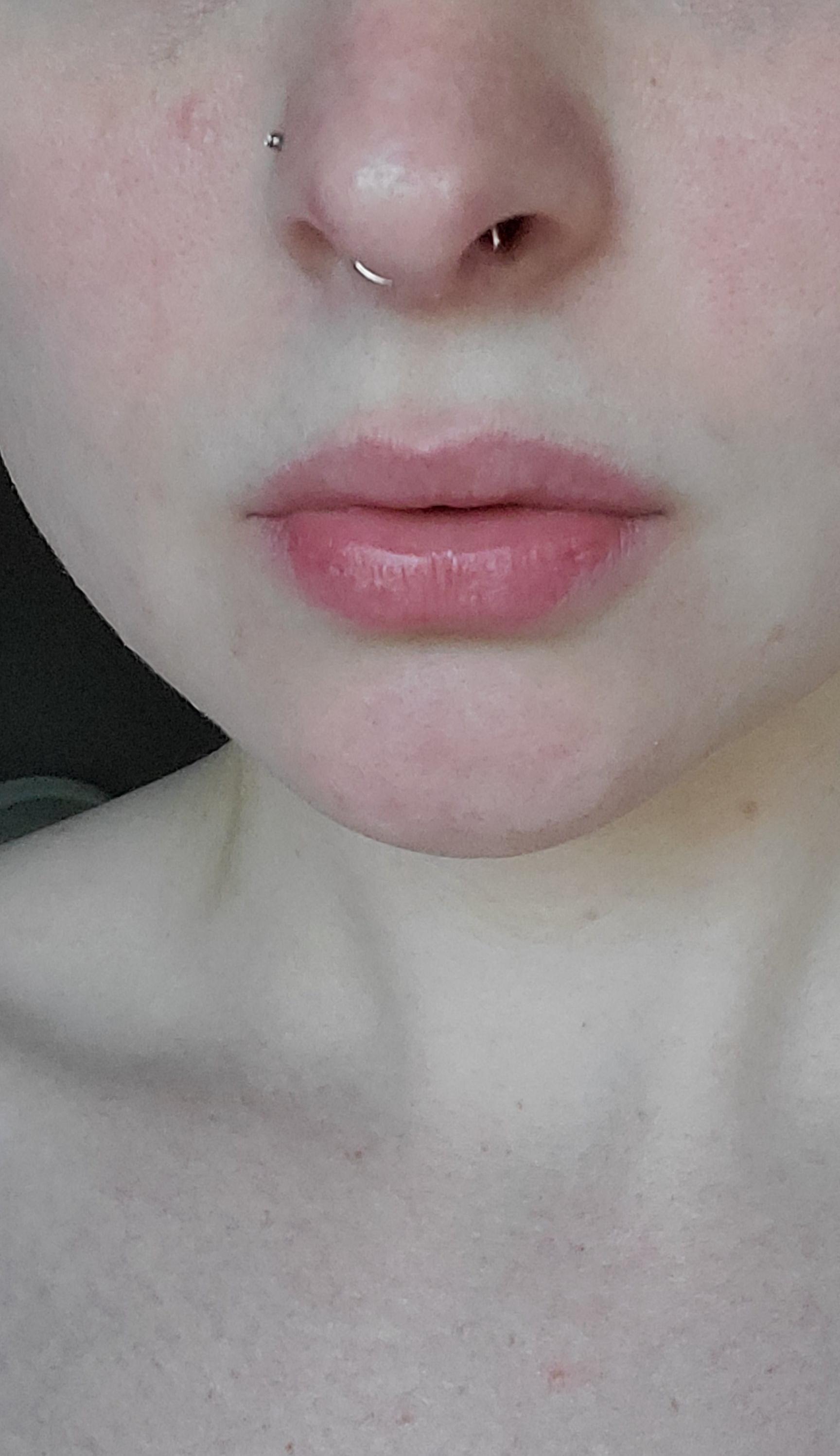 Hinge septum piercing stuck in nose. How can I get it out? it won't move in either direction