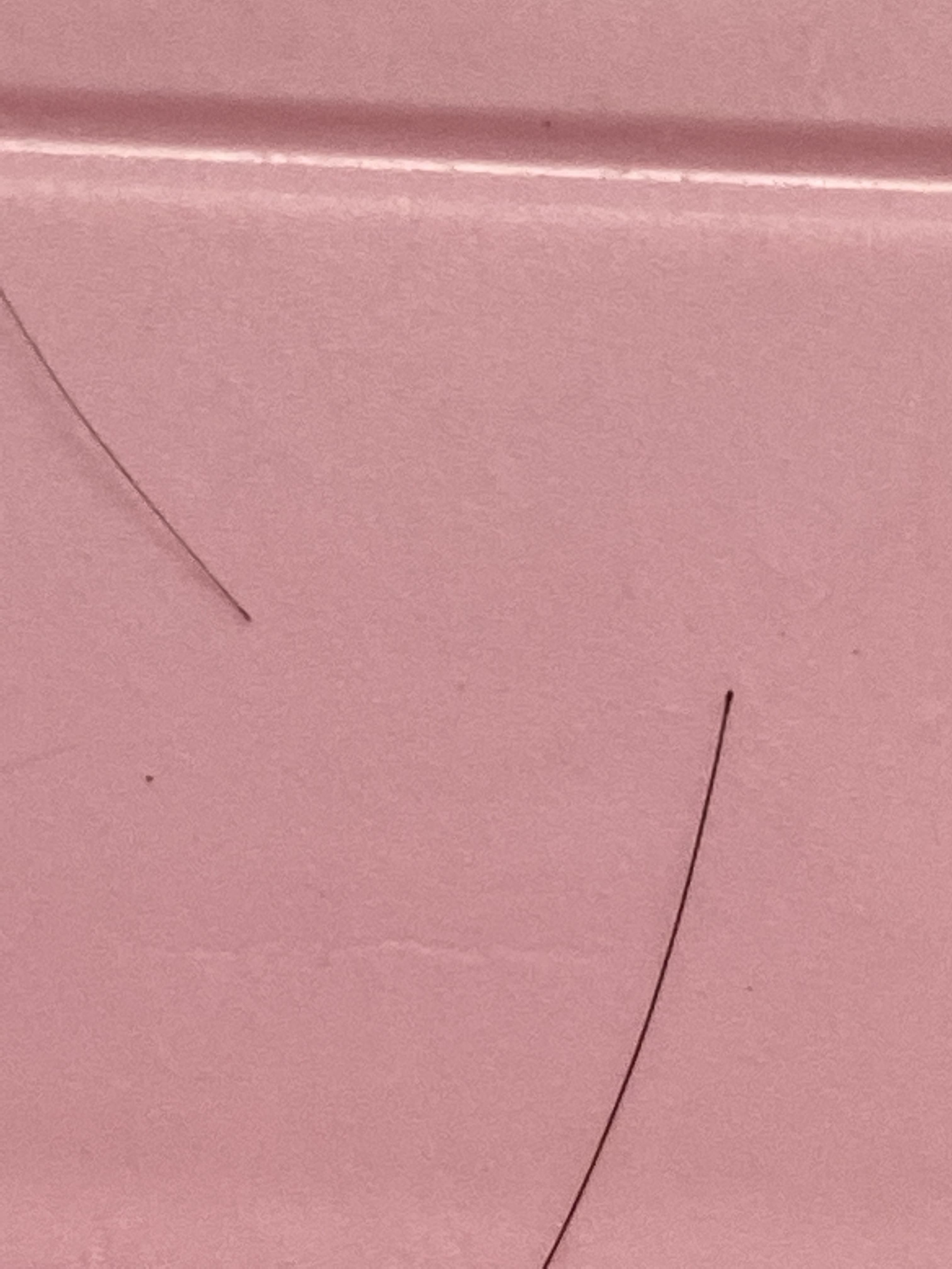 Hi, I have been noticing excessive hair loss for 2 years. I know the