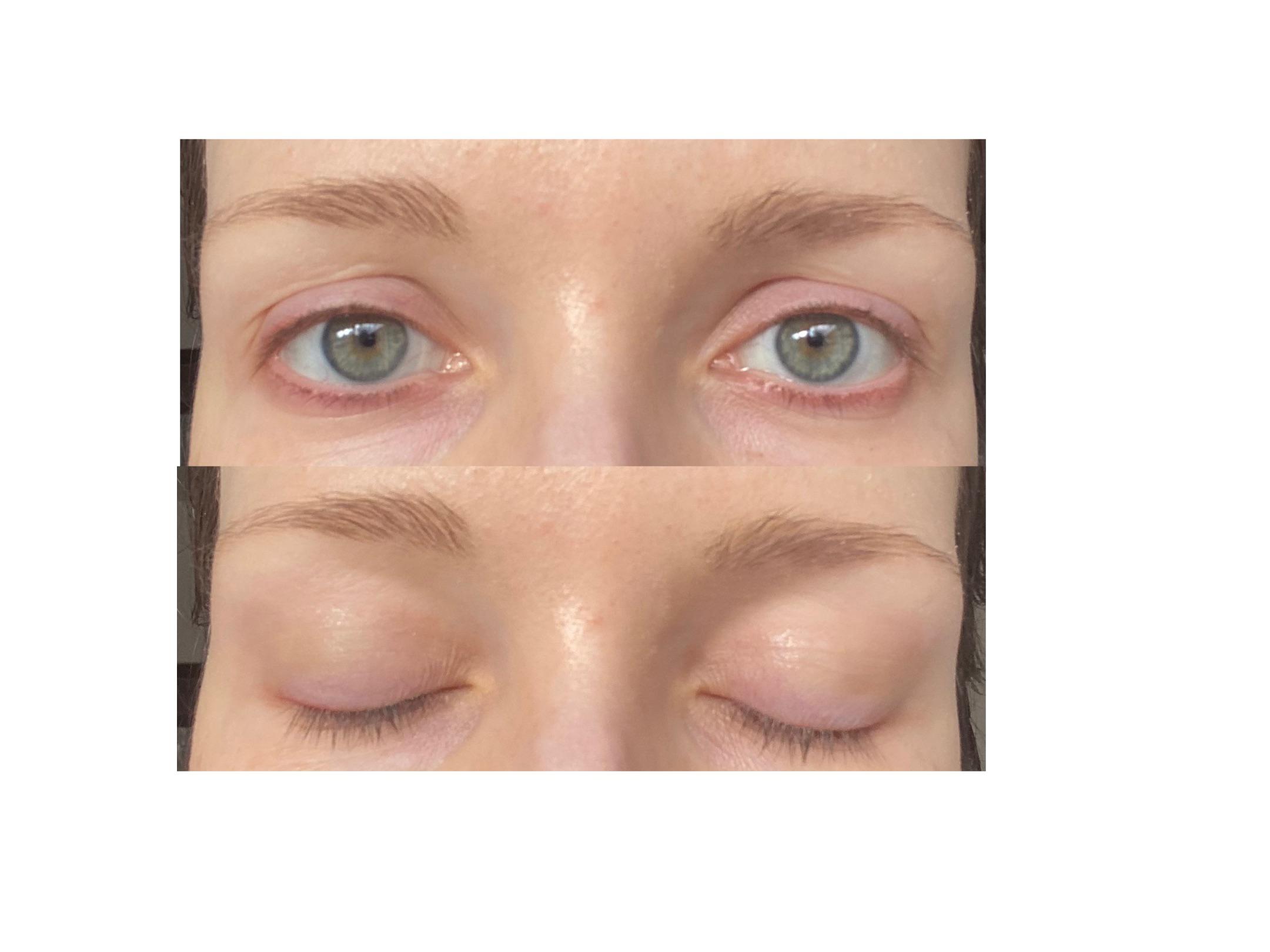 Do I have downturned eyes, or what is my eye shape? r/MakeupAddiction