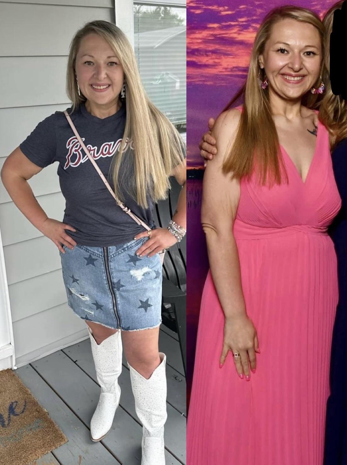 Hey, Bestie, why aren’t you showing a side by side proving you haven’t