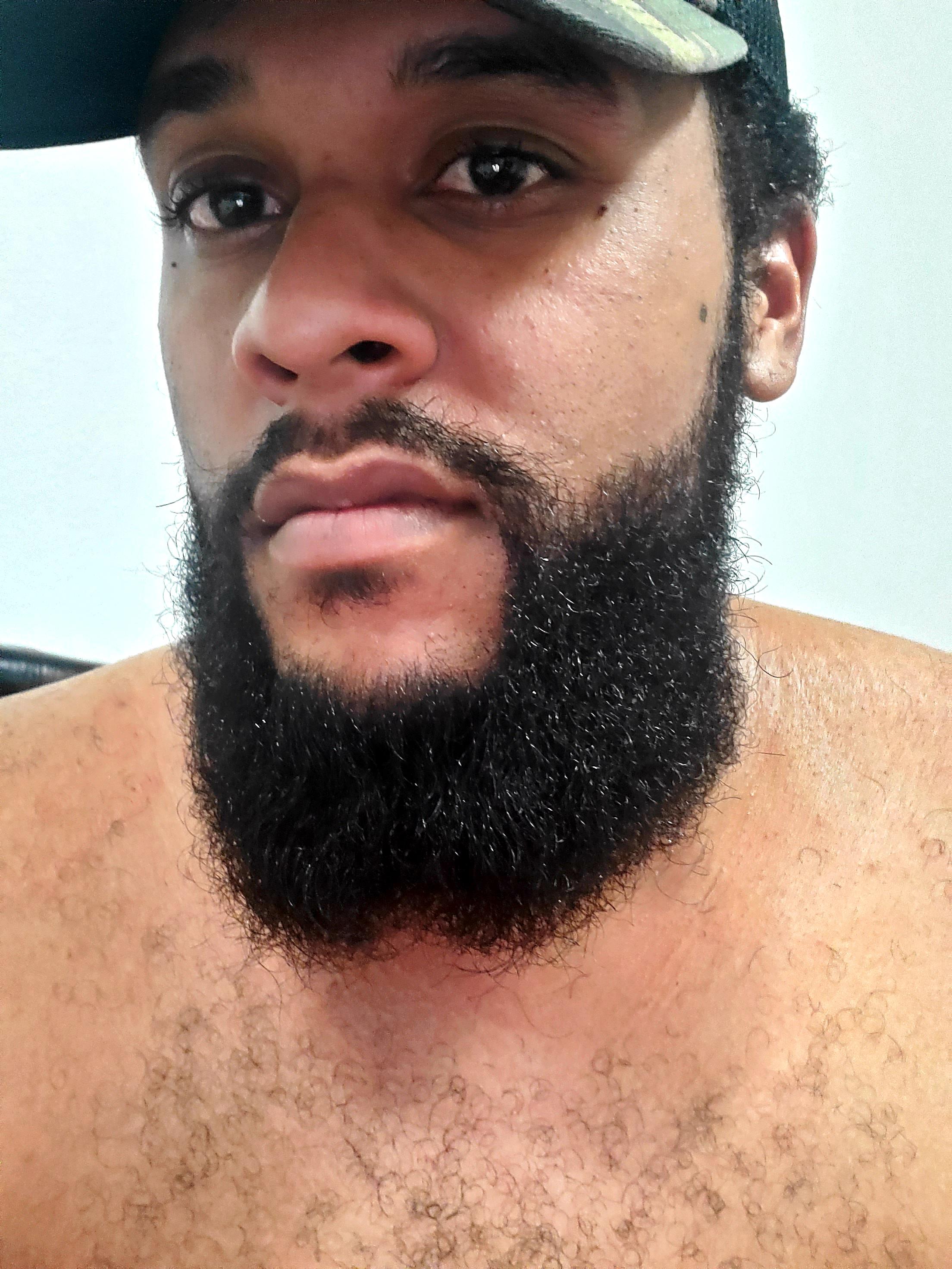 I have super coarse beard hair and finally after a few months and