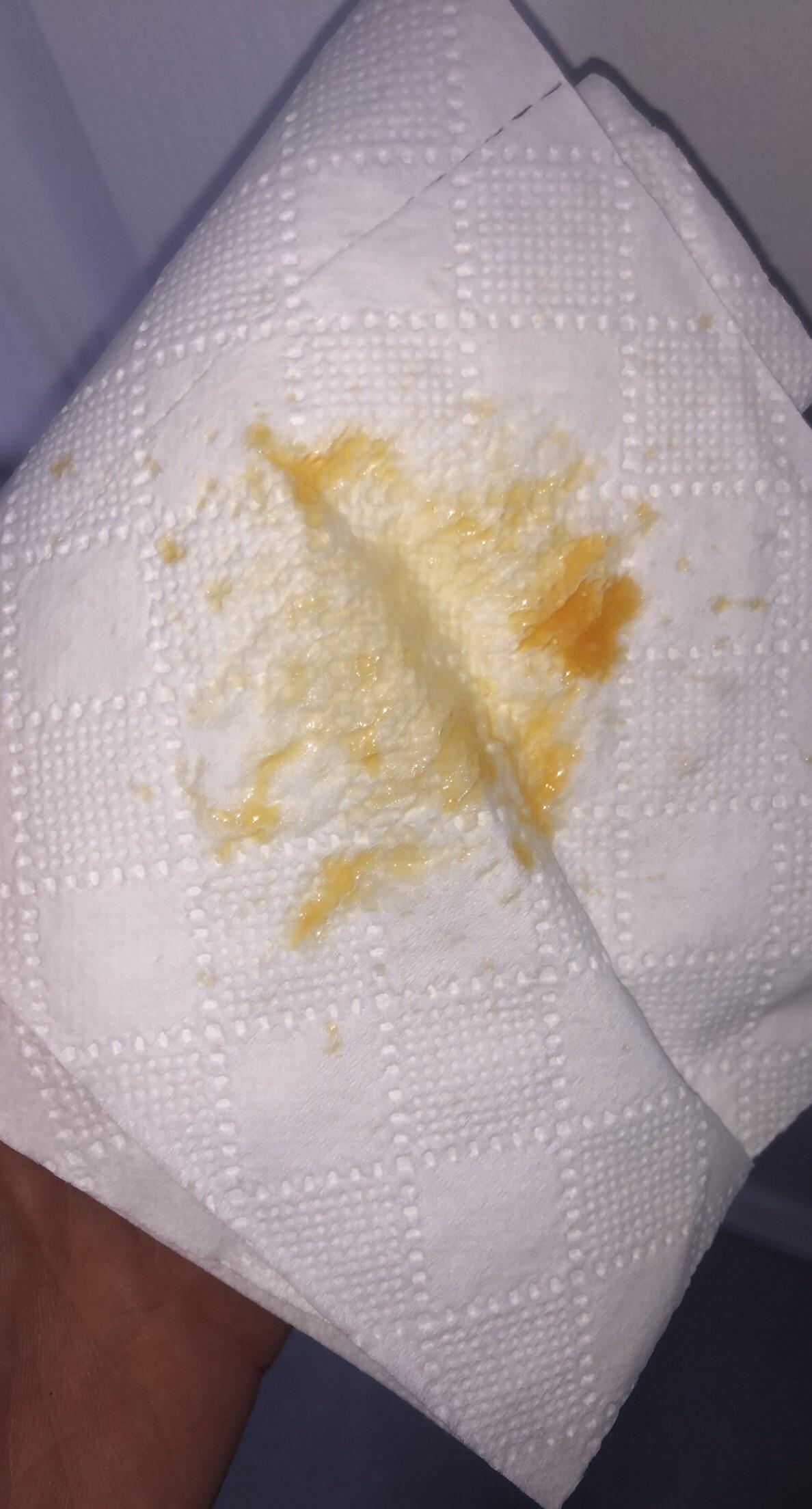 My snot is orange. Why is this? I’ve had a cold for over two weeks for